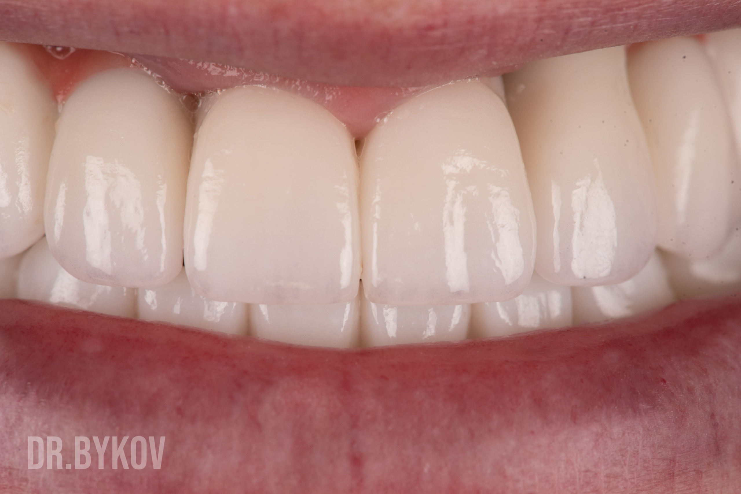 Портфолио. Врач стоматолог-ортопед Быков Алексей