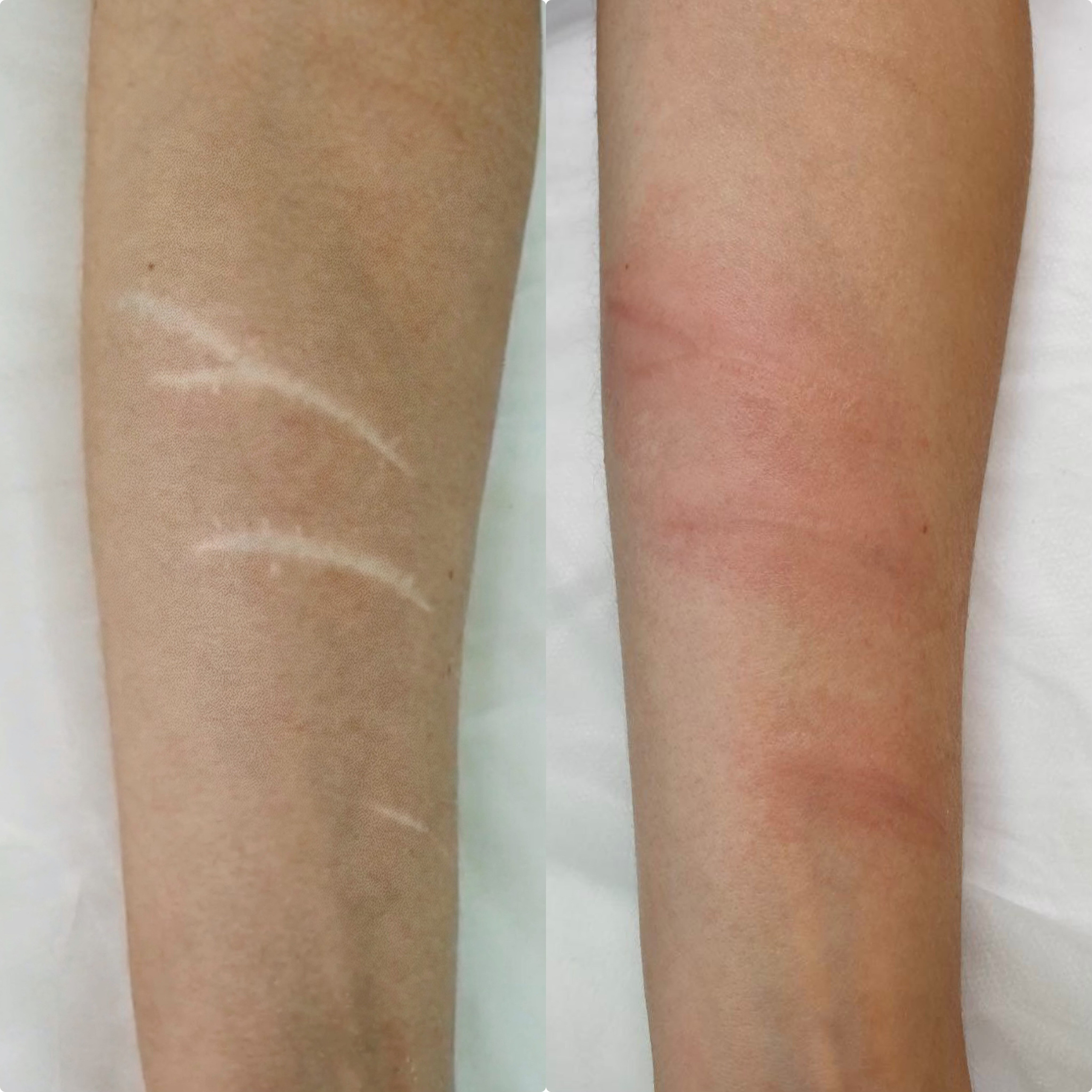 Элла. Студия перманентного макияжа, косметологии и массажа SYMMETRY в Москве, м. Киевская