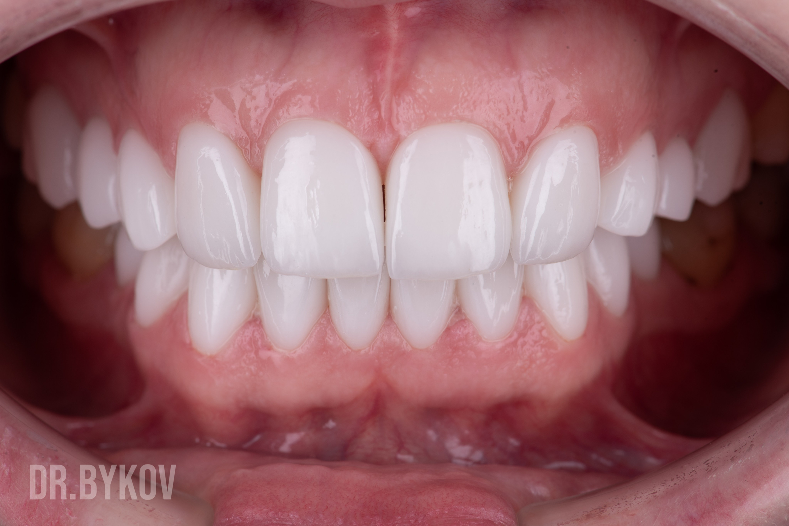 Портфолио. Врач стоматолог-ортопед Быков Алексей