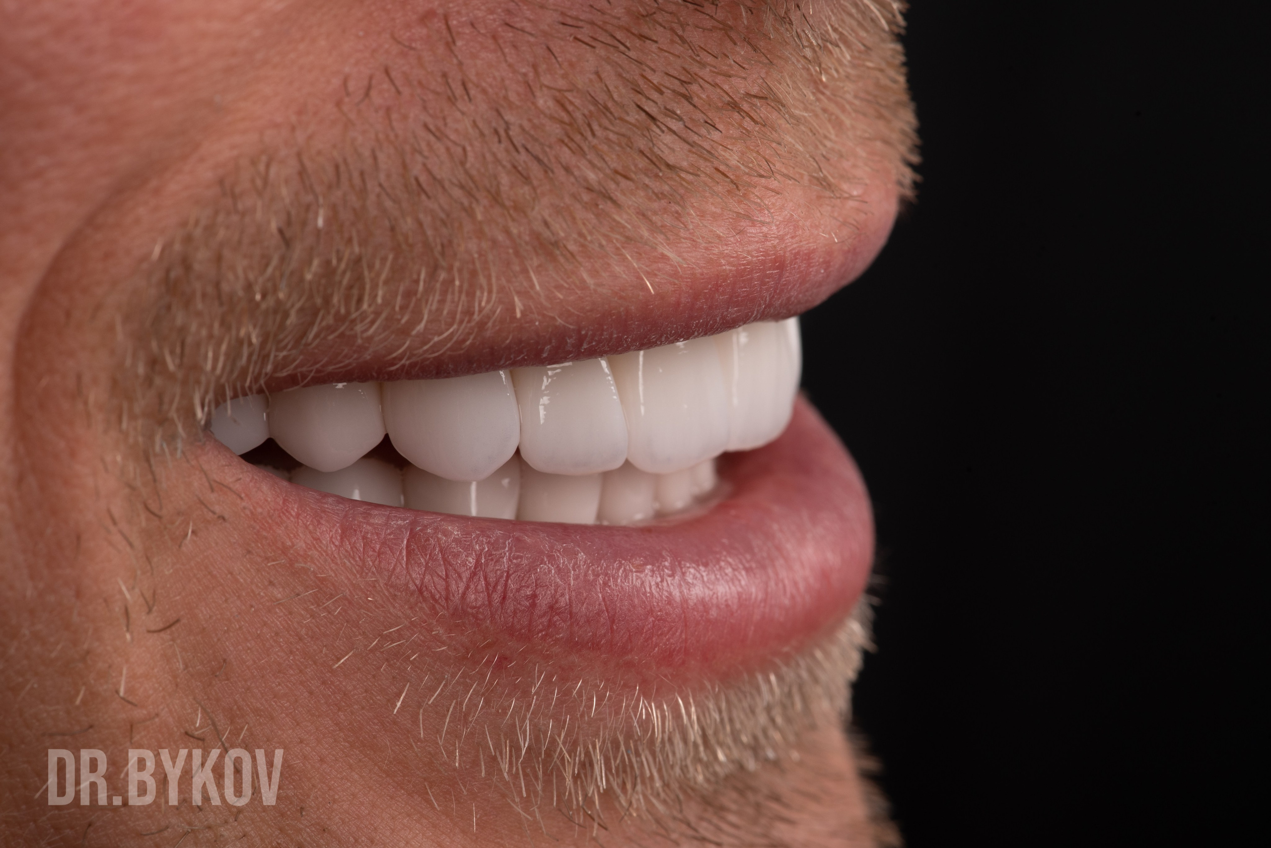 Портфолио. Врач стоматолог-ортопед Быков Алексей