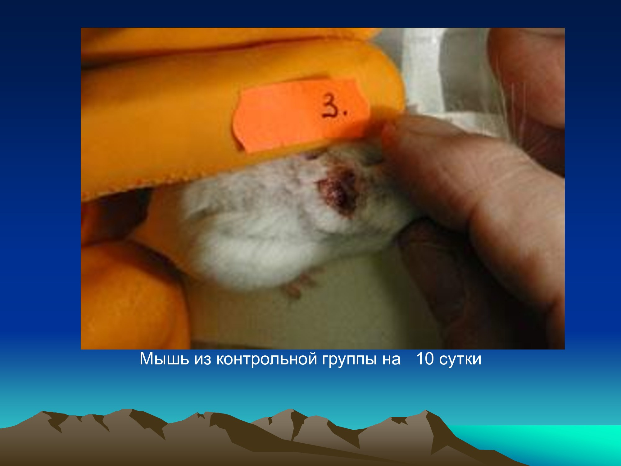 Специализированное медицинское устройство, предназначенное для воздействия на очаг патологии, БАТ электромагнитного излучения, генерируемое прибором.