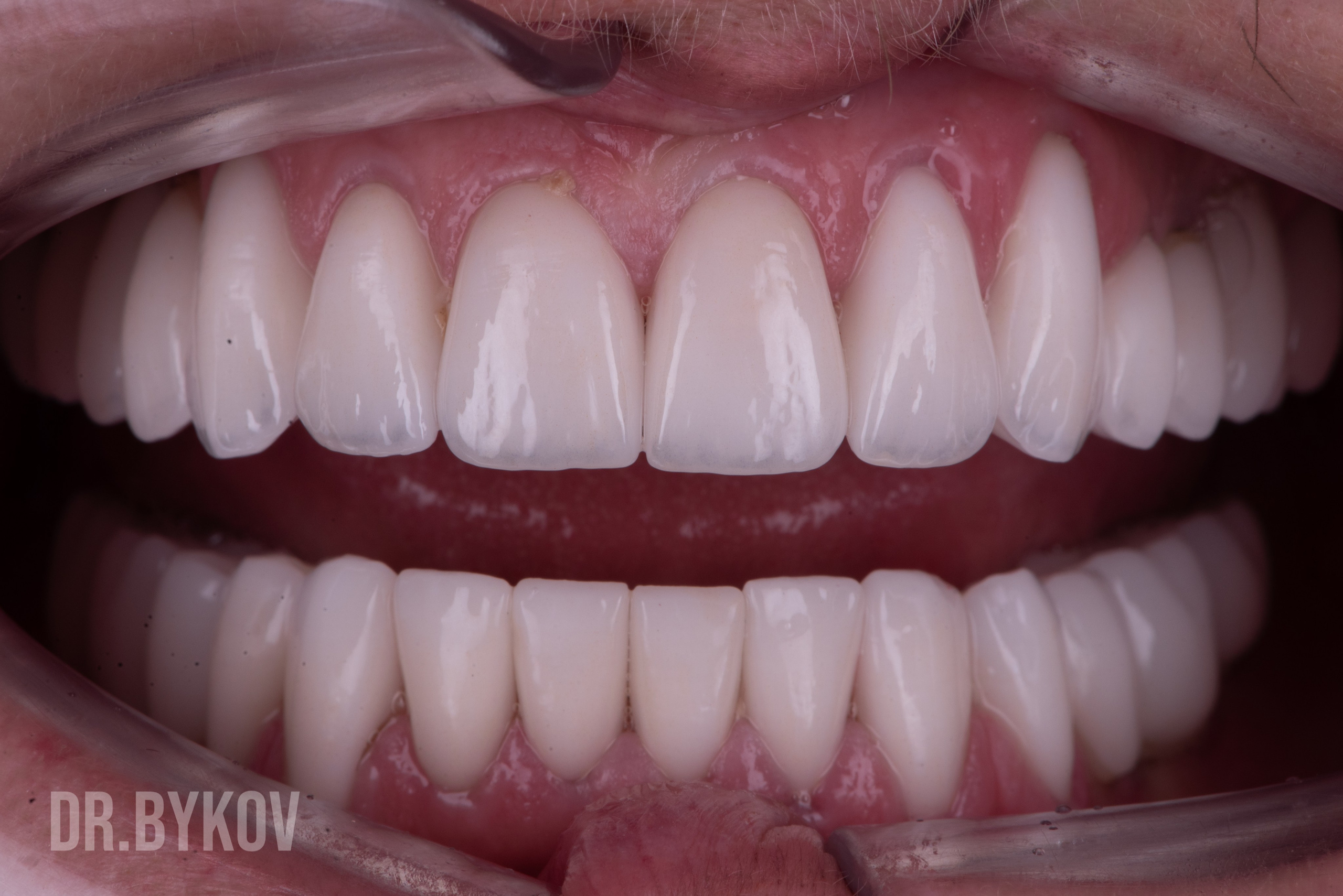 Портфолио. Врач стоматолог-ортопед Быков Алексей