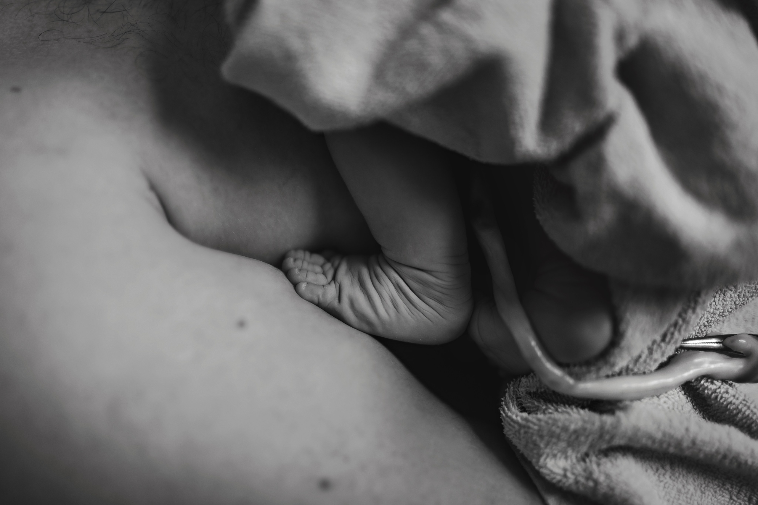 C-Section Birth Photography in Austin, TX