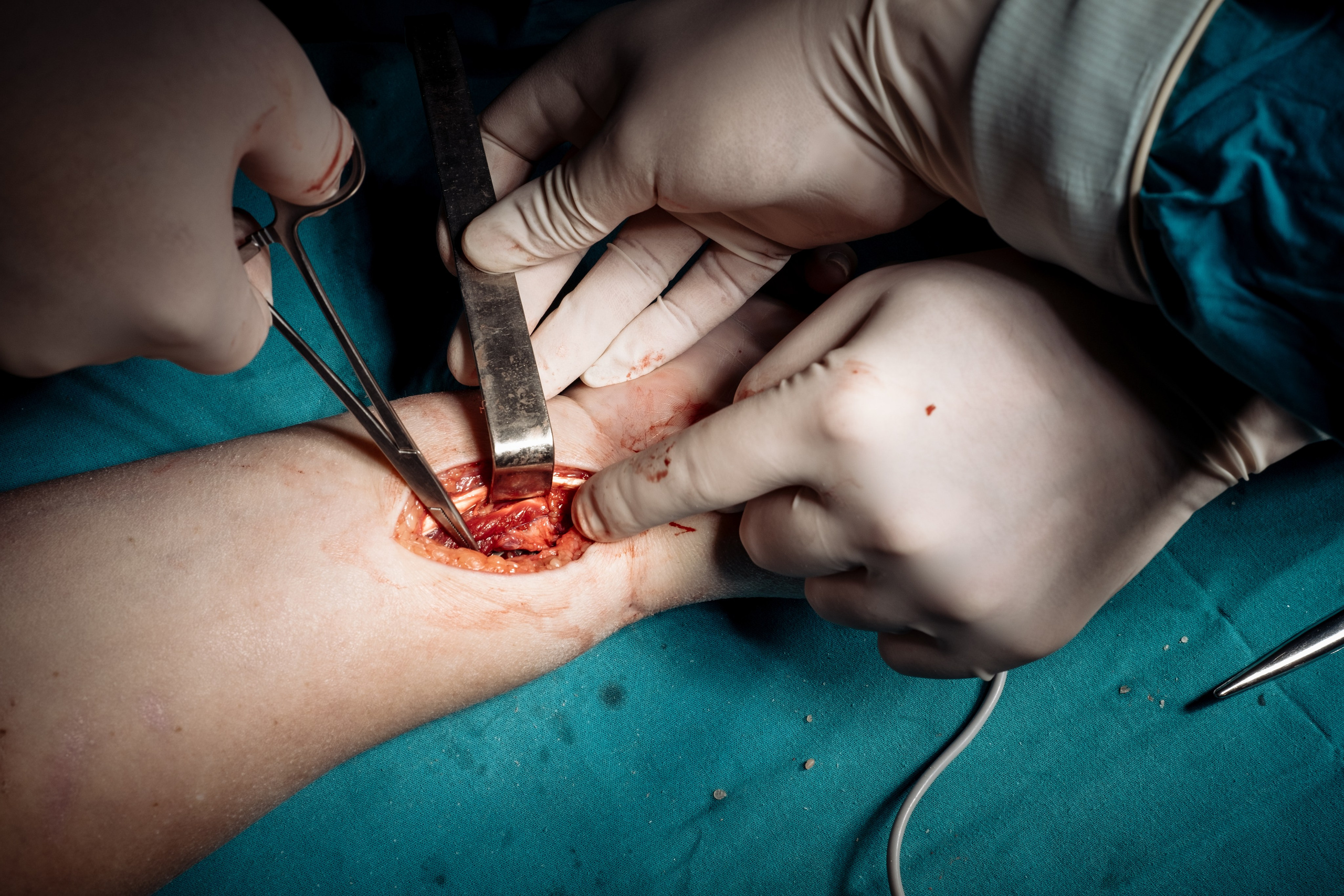 Операция. Фотограф и видеограф Анна Жагорина