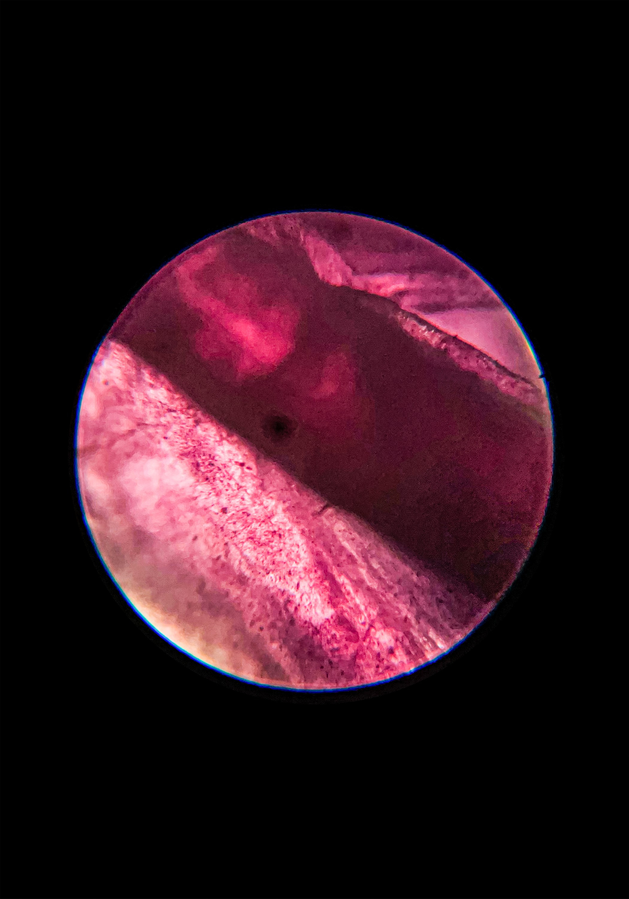 Микроскопластикопия / 2022. Туман Зла