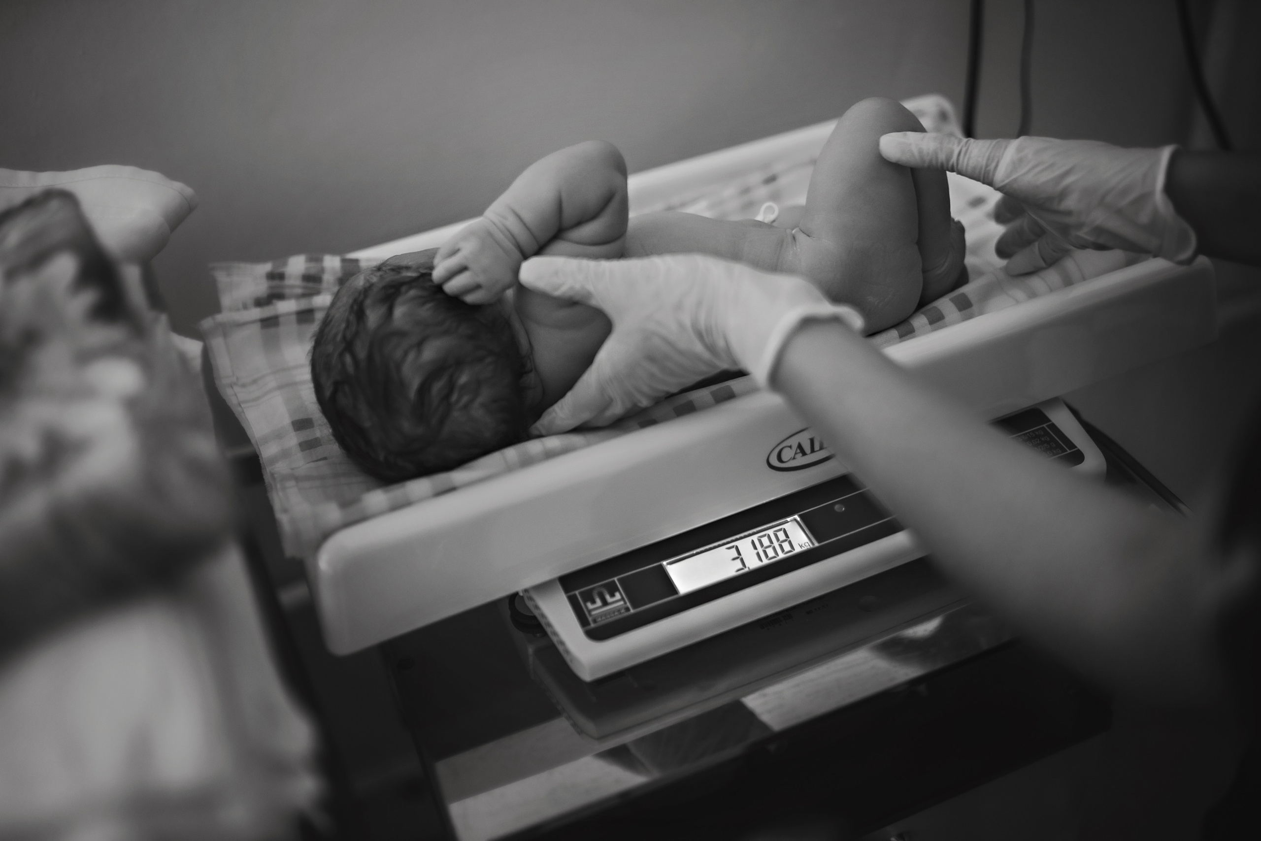 C-Section Birth Photography in Austin, TX