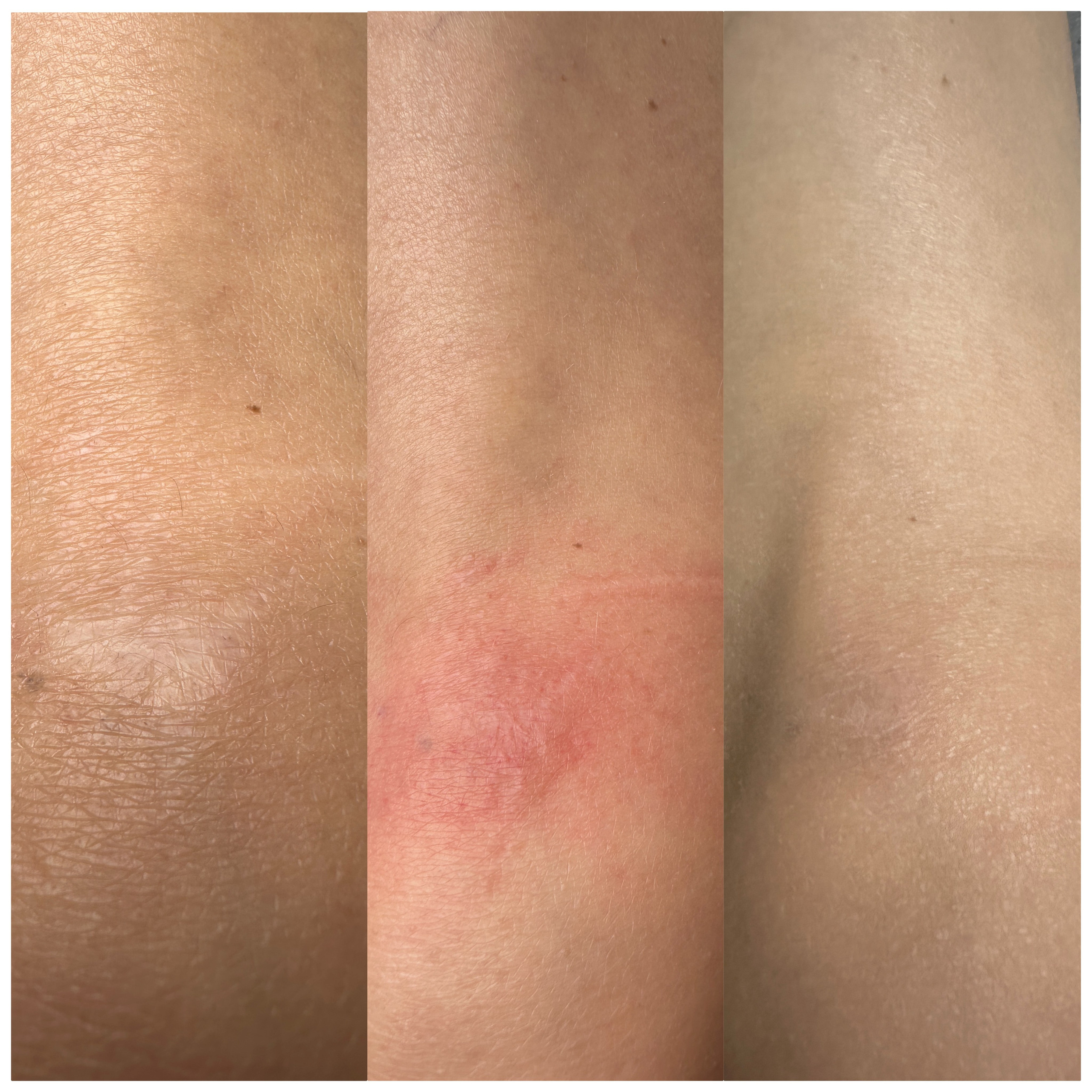 Элла. Студия перманентного макияжа, косметологии и массажа SYMMETRY в Москве, м. Киевская