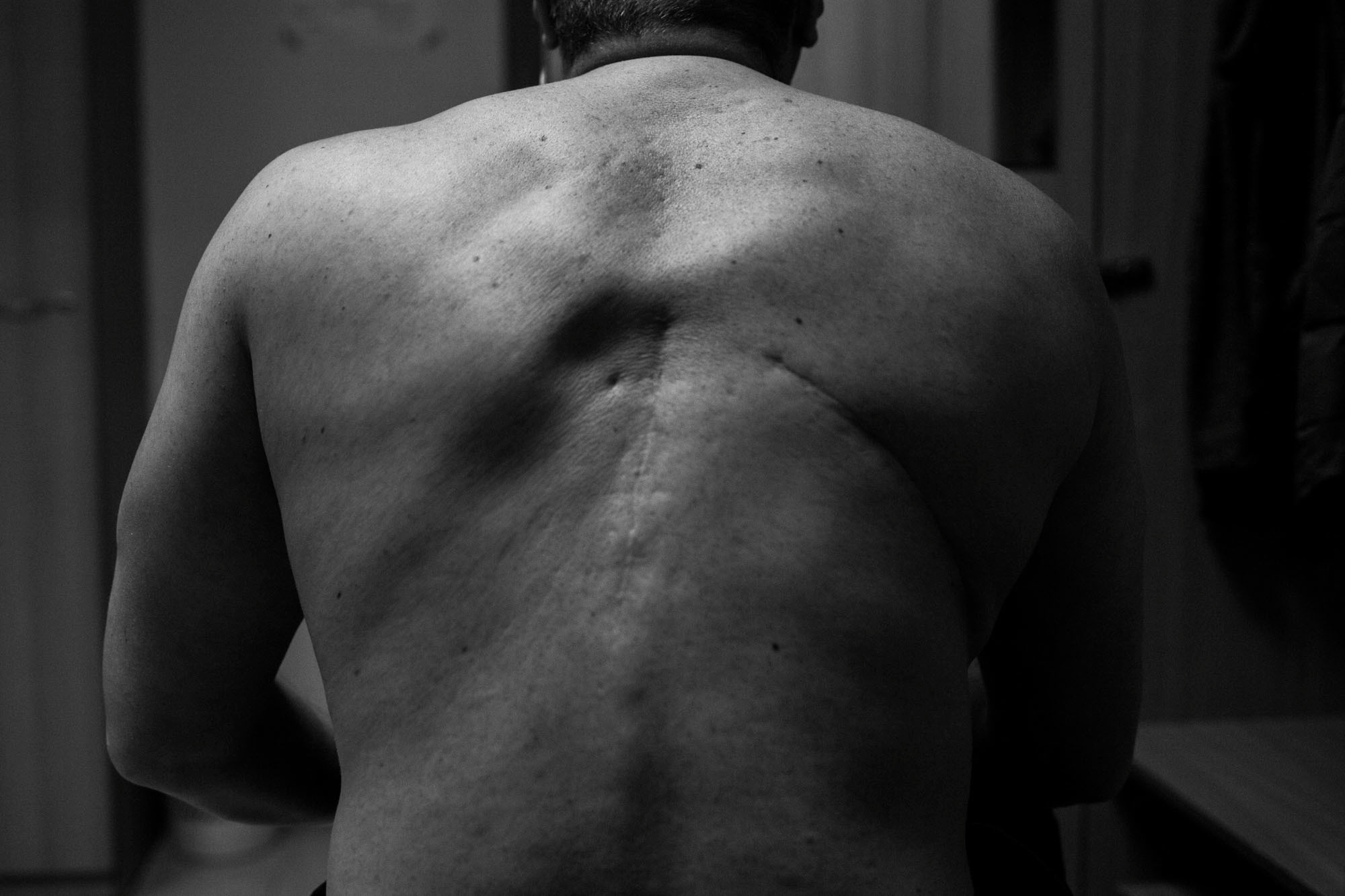 Documentary project Andrei. Documentary photographer Tatiana Bormatova