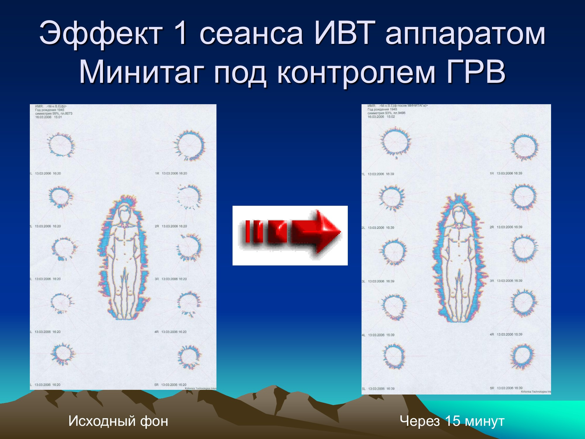 Специализированное медицинское устройство, предназначенное для воздействия на очаг патологии, БАТ электромагнитного излучения, генерируемое прибором.