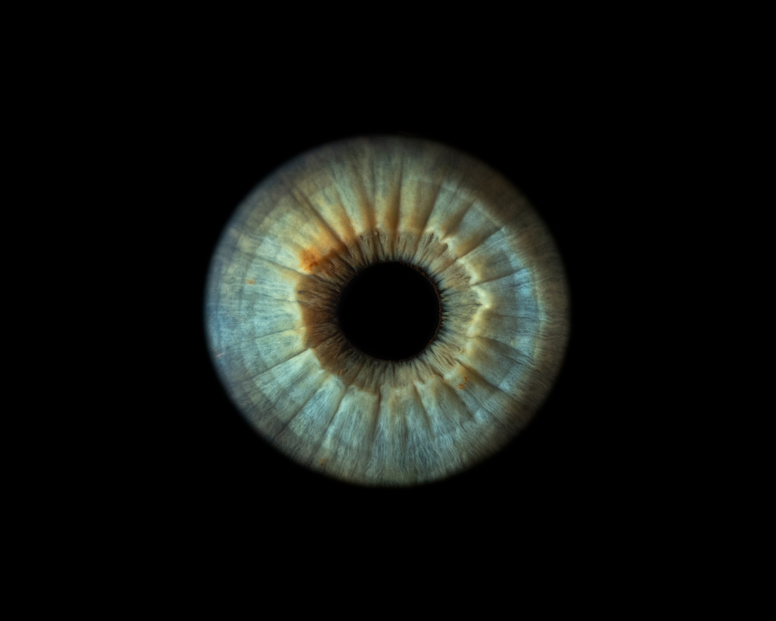 Фото радужки глаза в высоком разрешении и детализации. Крым, Севастополь. Ojo Art