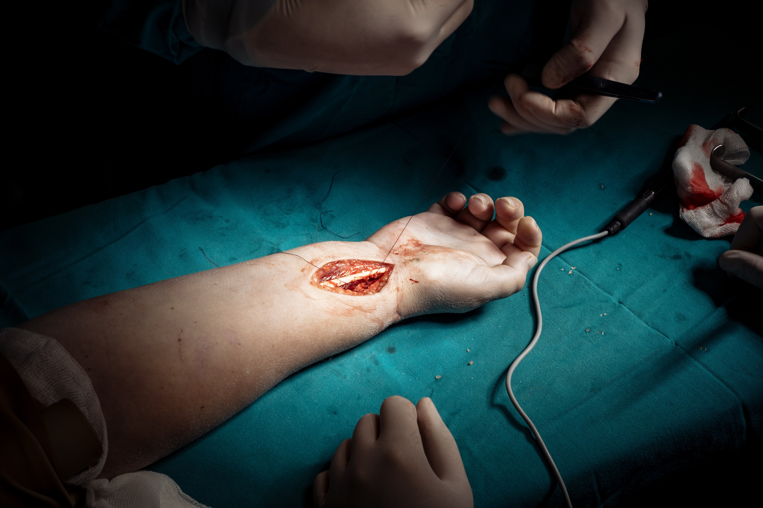 Операция. Фотограф и видеограф Анна Жагорина