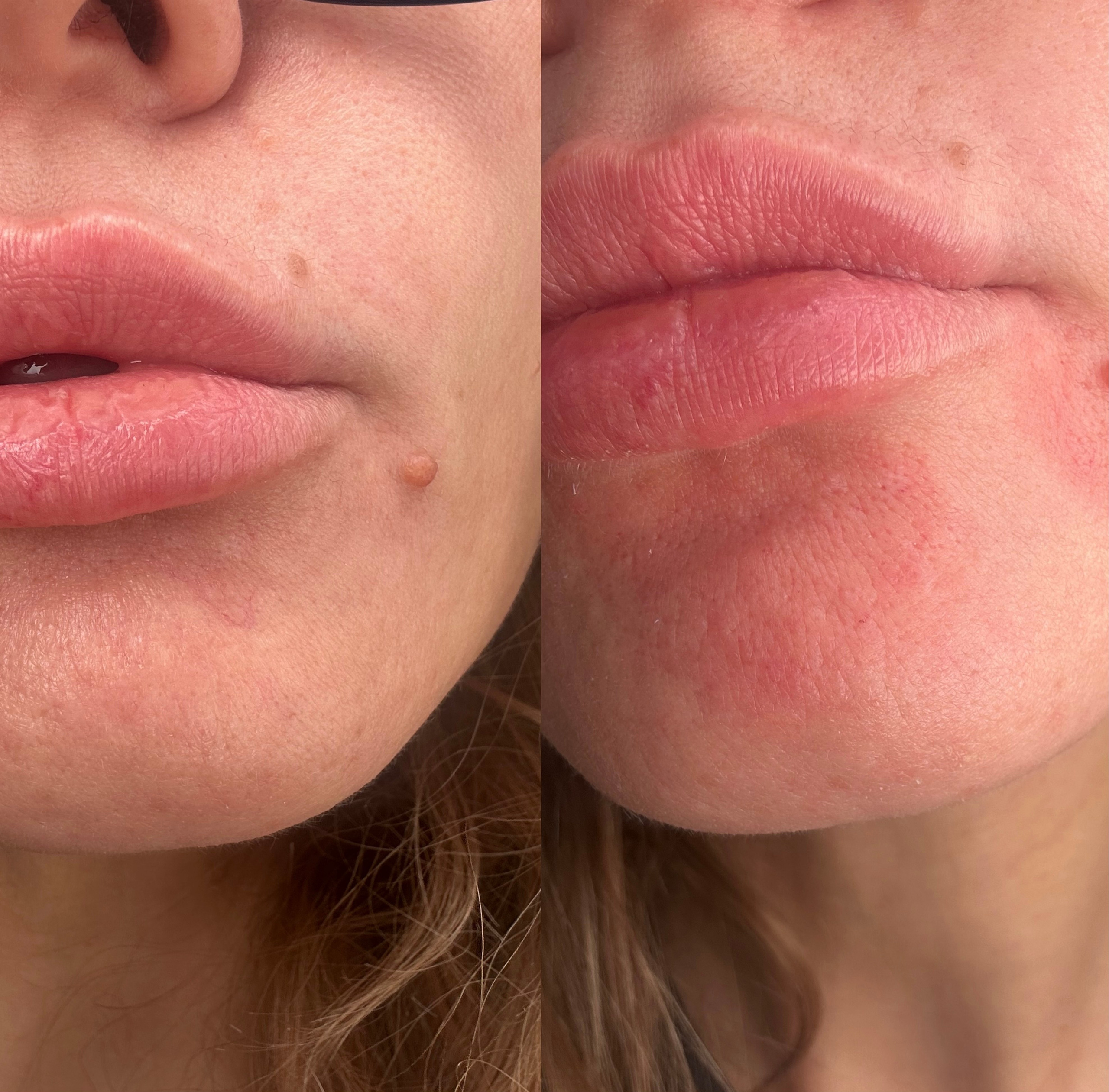 Элла. Студия перманентного макияжа, косметологии и массажа SYMMETRY в Москве, м. Киевская