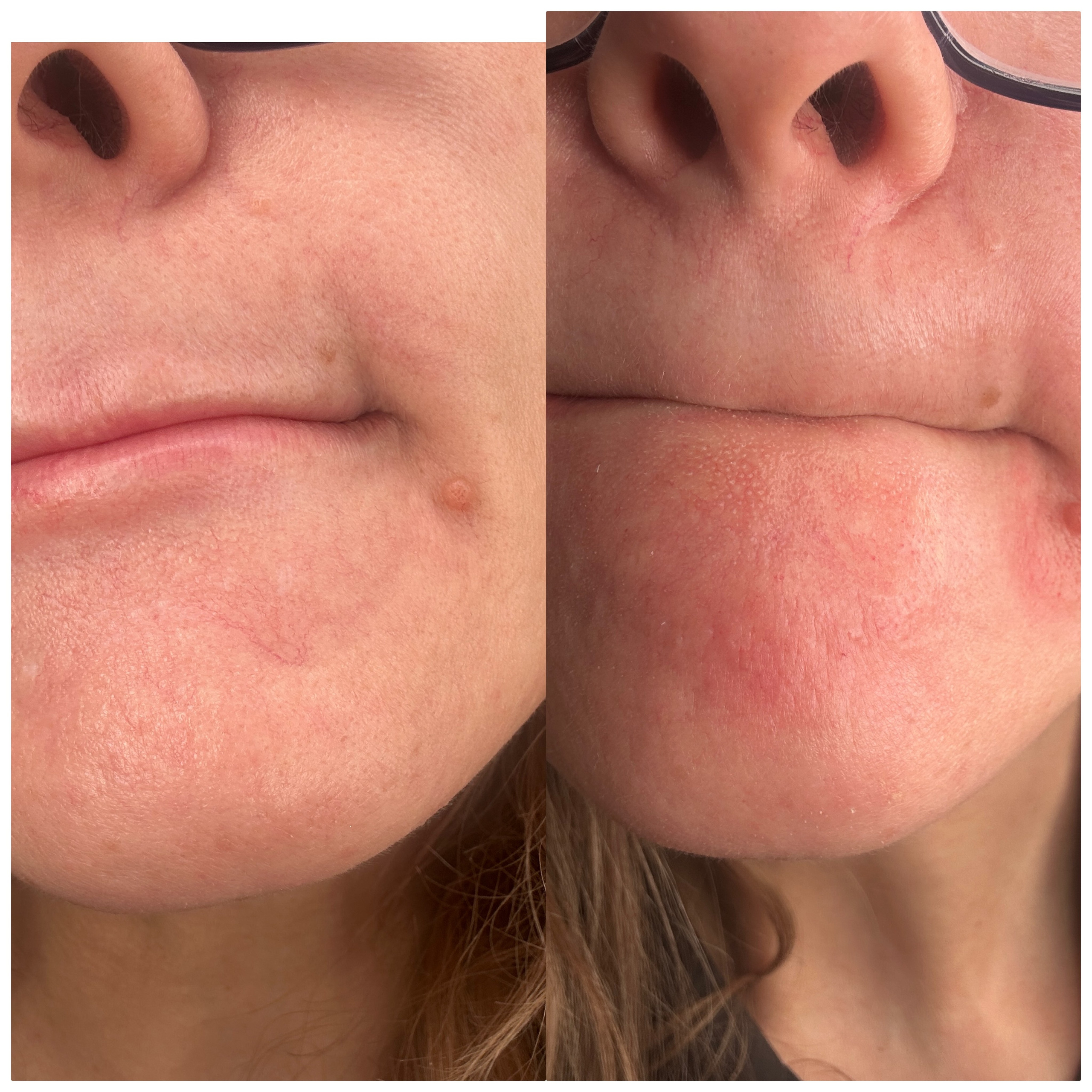 Элла. Студия перманентного макияжа, косметологии и массажа SYMMETRY в Москве, м. Киевская