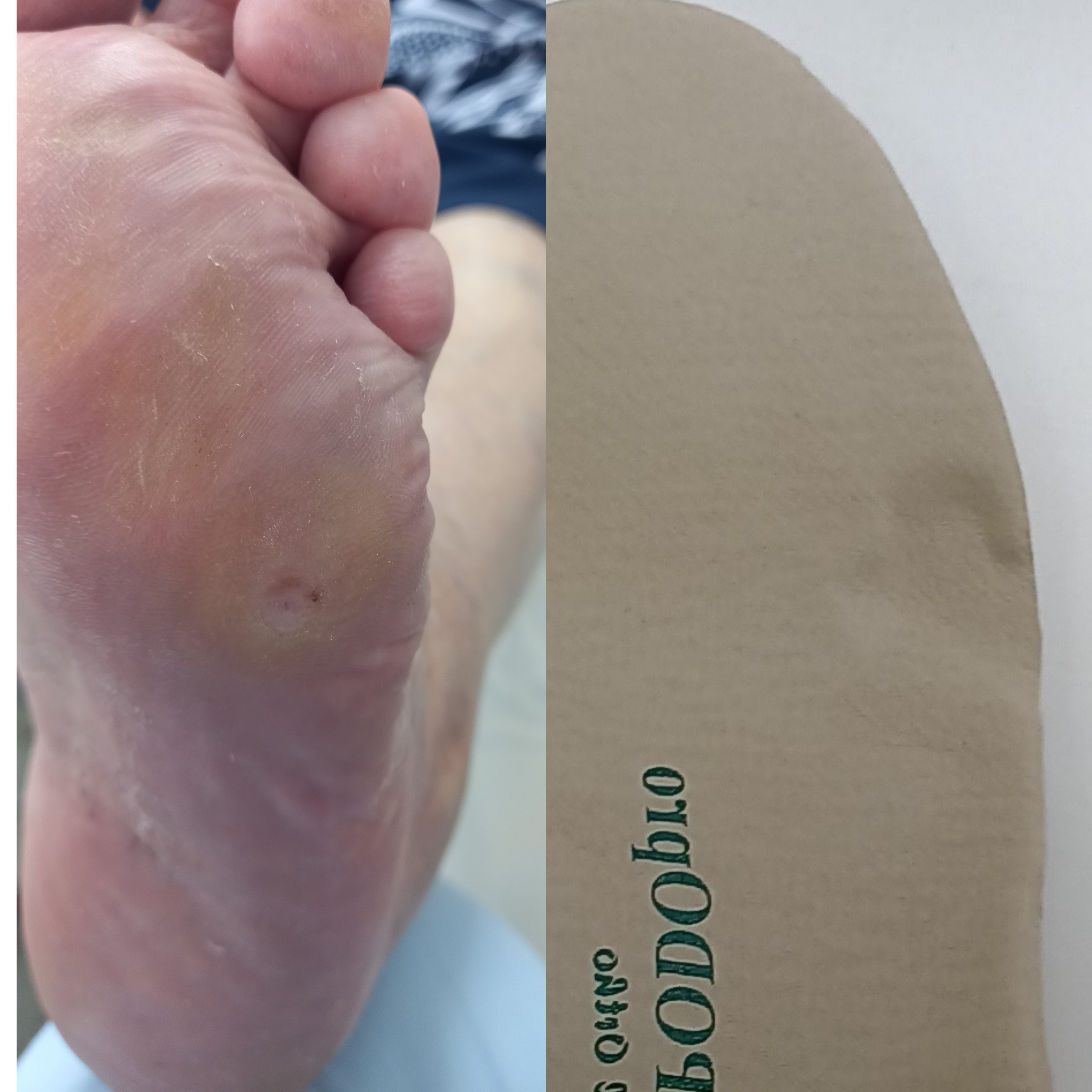 Стельки — соты. Подолог г. Хабаровск — центр здоровой стопы «FOOTTIME»