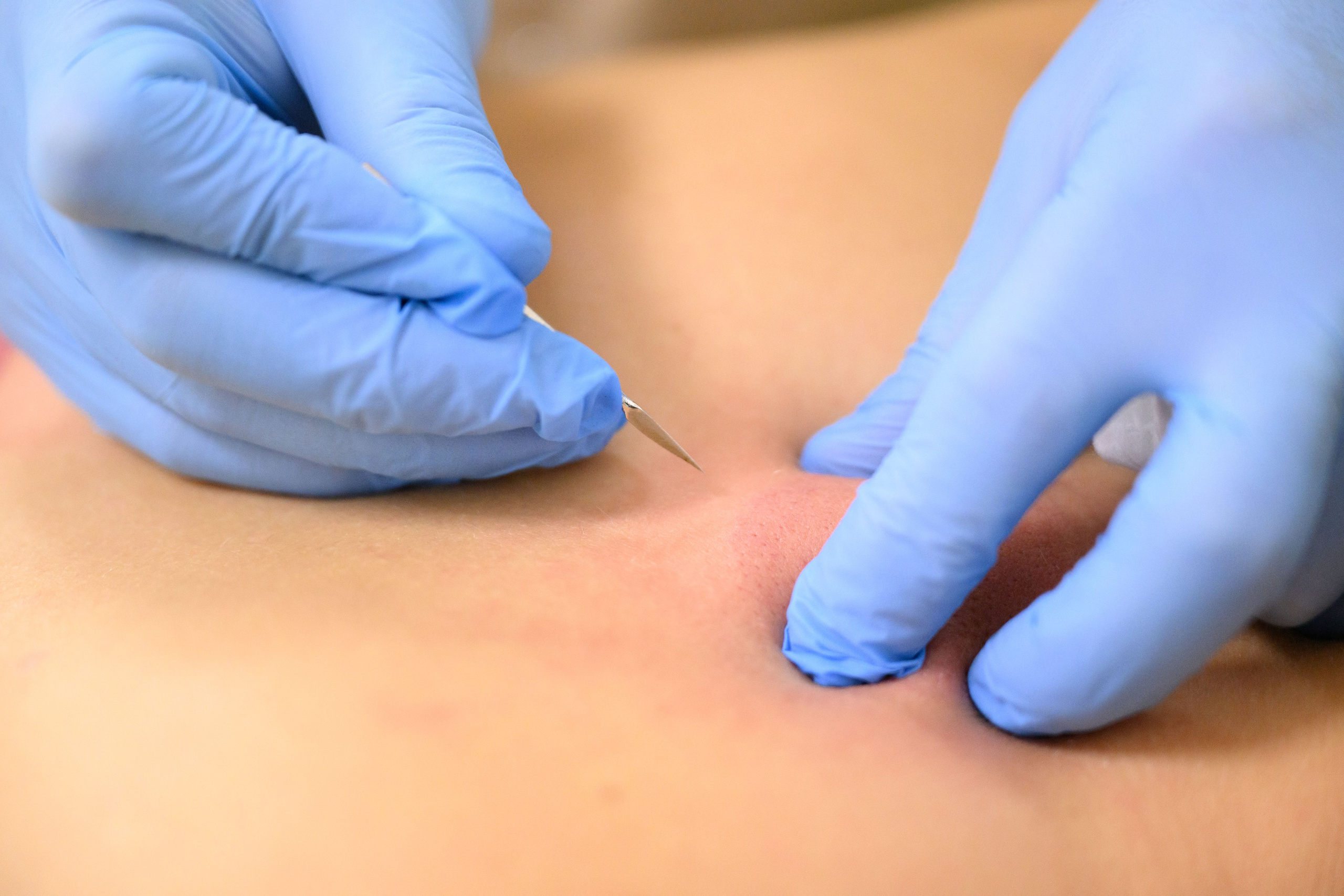 Китайская медицины при похудении. Шаг за шагом