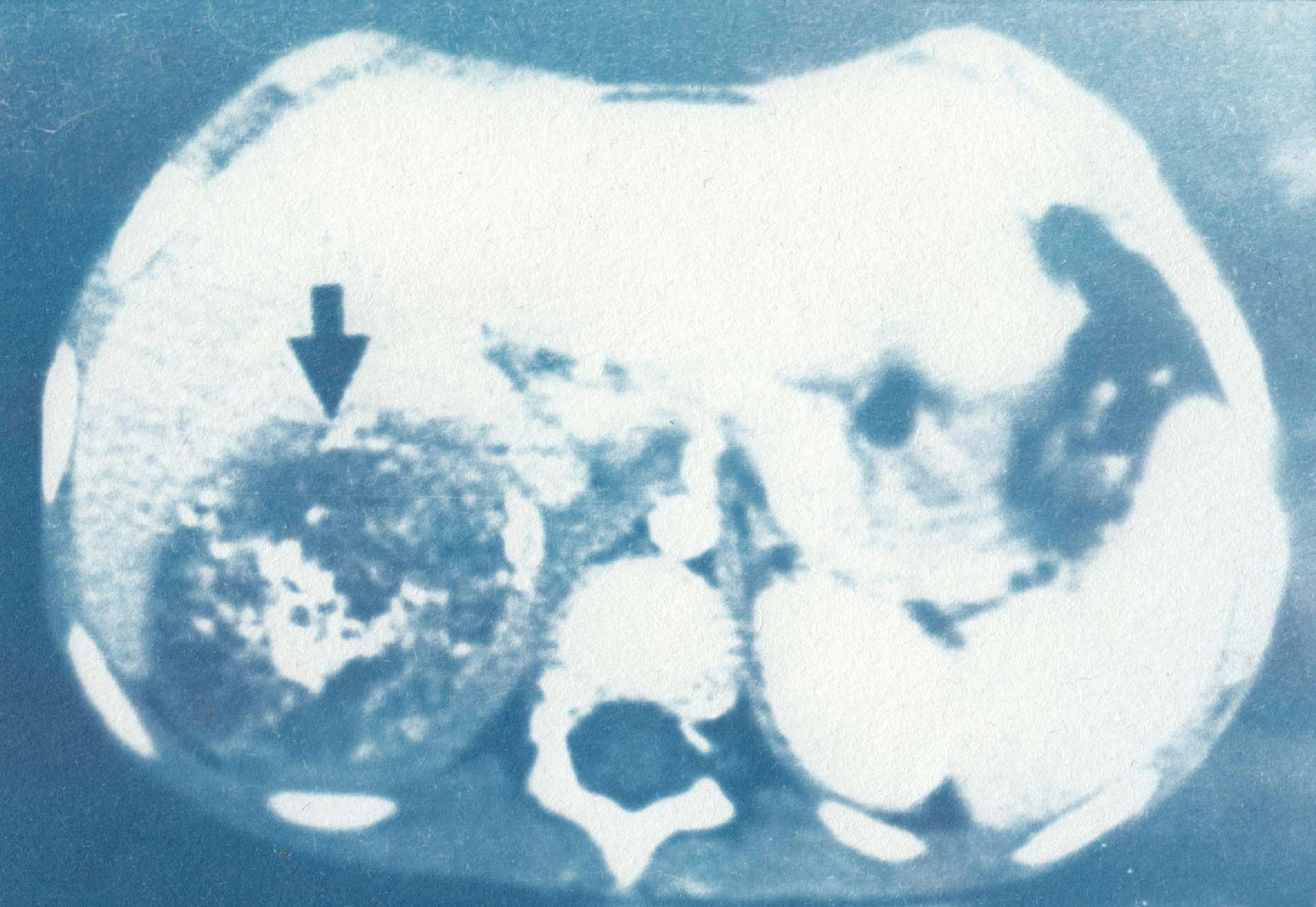 When you leave us, I'll live in your room. Maria Pilkevich