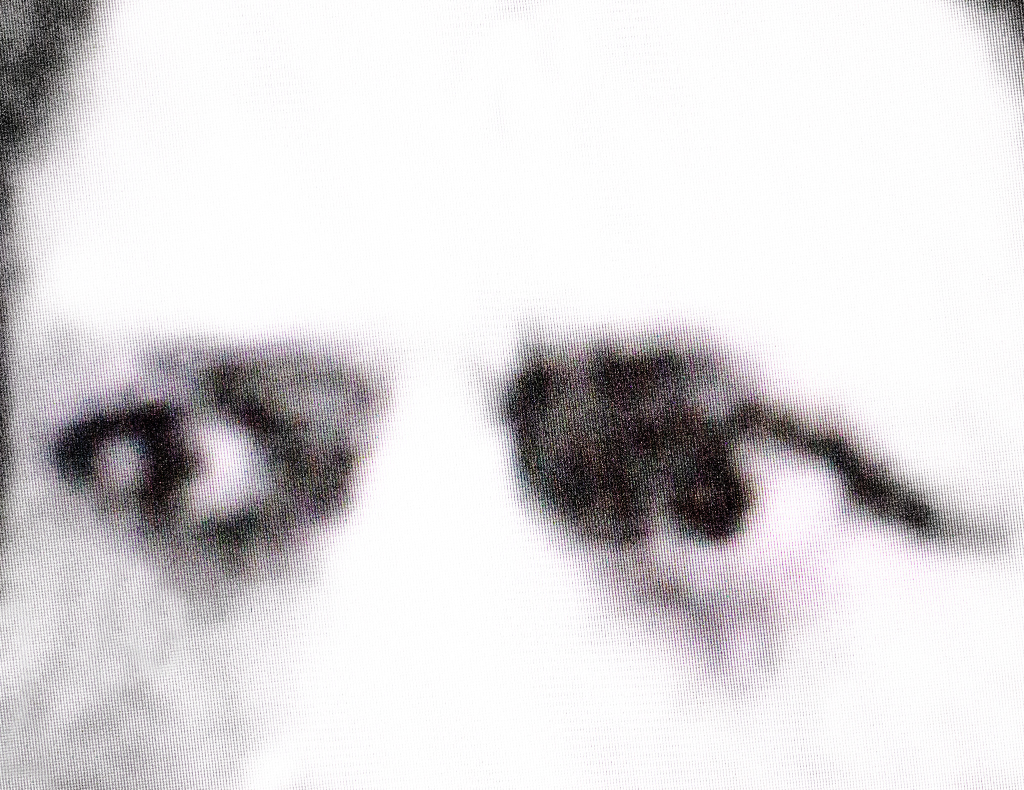 Phobia. Alexander Zorin