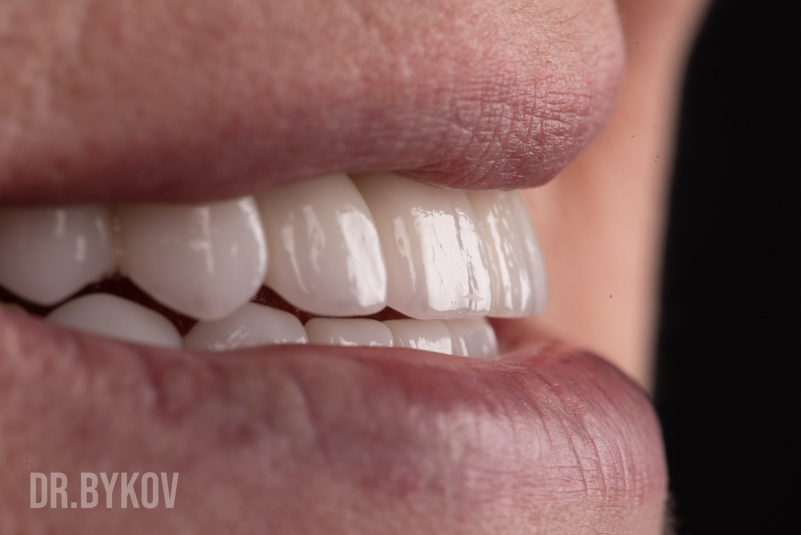 Портфолио. Врач стоматолог-ортопед Быков Алексей