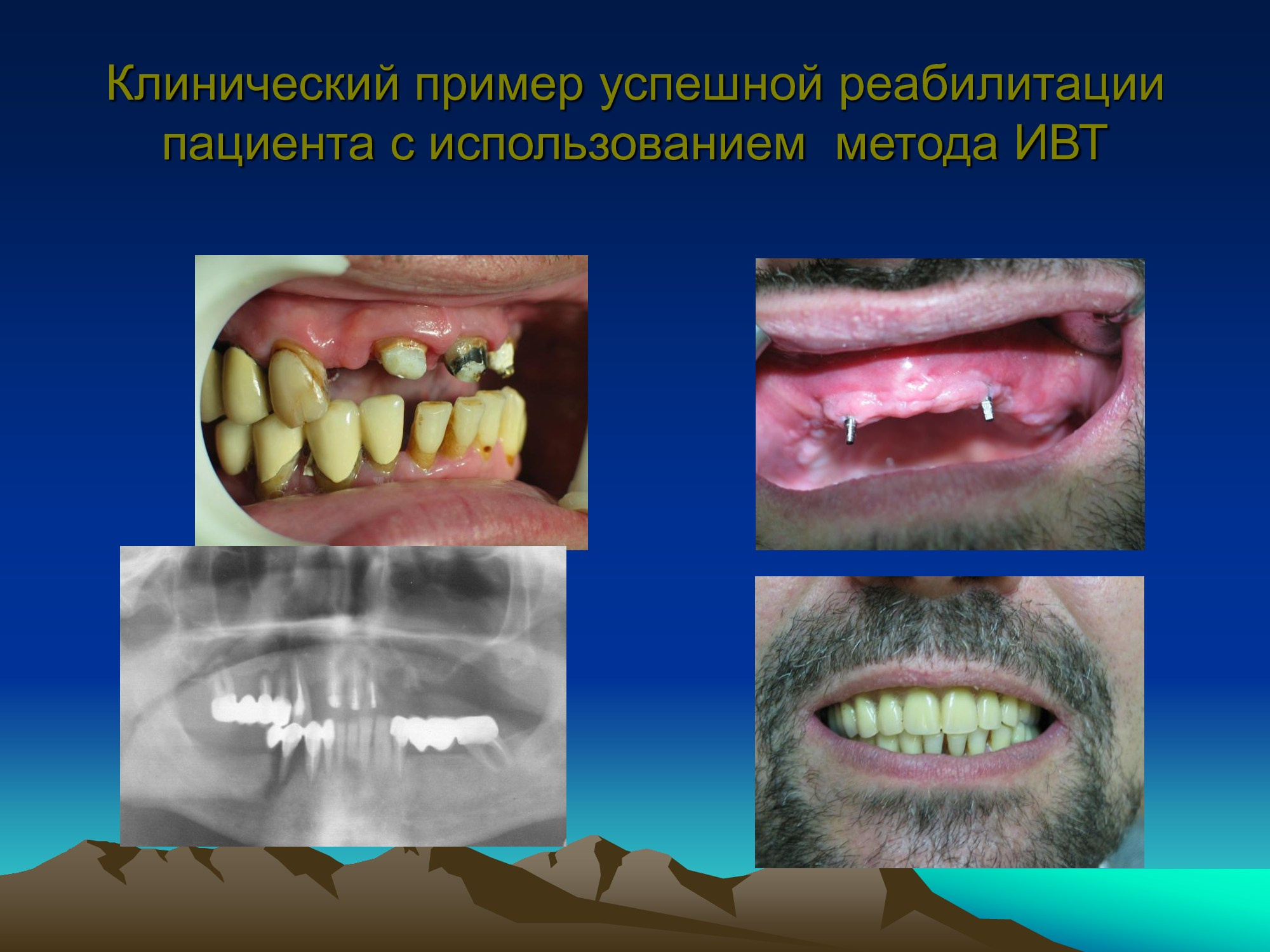 Специализированное медицинское устройство, предназначенное для воздействия на очаг патологии, БАТ электромагнитного излучения, генерируемое прибором.