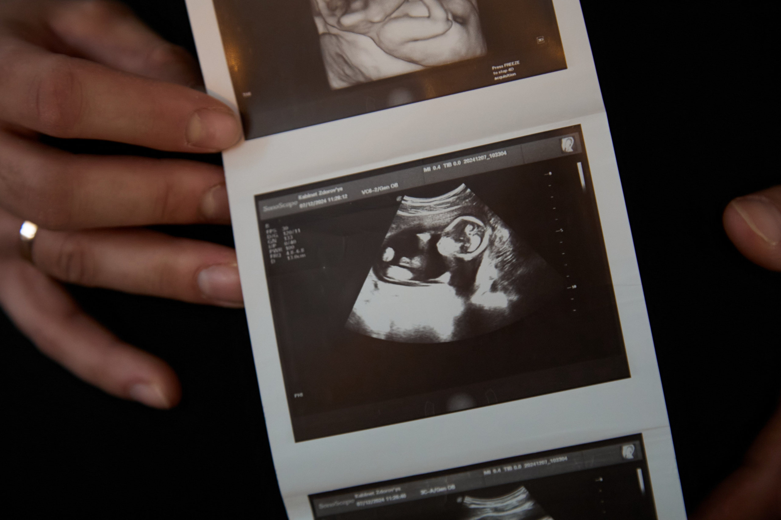 «Чудо». Свадебный и креативный фотограф в ЮФО и МСК