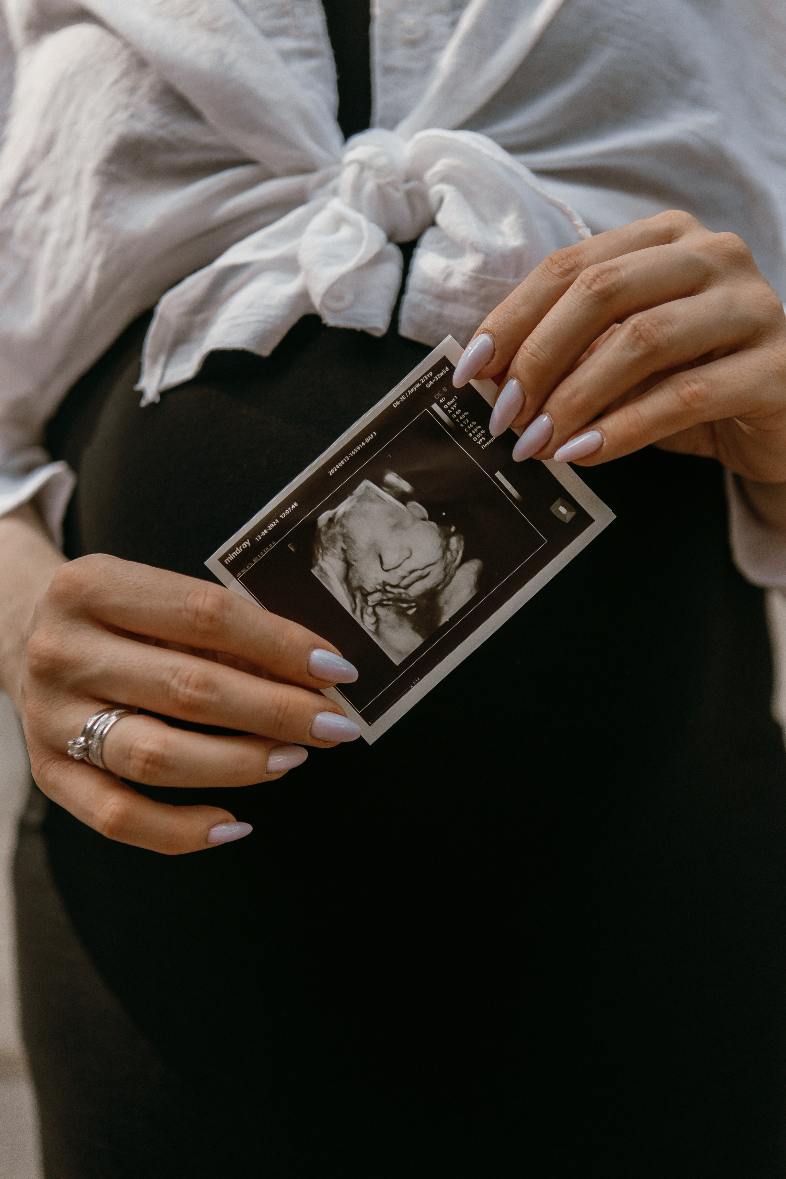 Виктория и Николай Царицыно. Свадебный фотограф в Москве