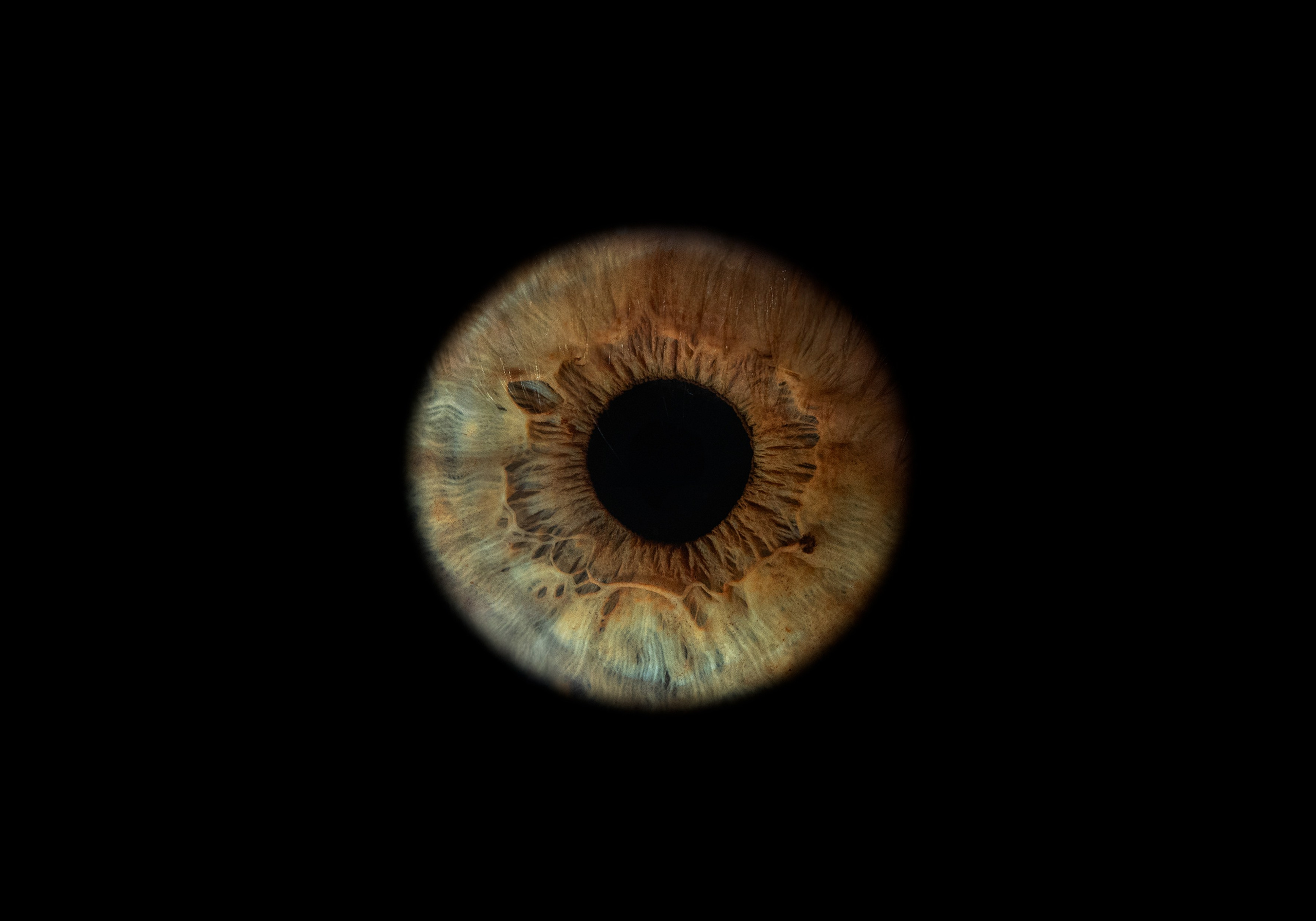 Фото радужки глаза в высоком разрешении и детализации. Крым, Севастополь. Ojo Art 1