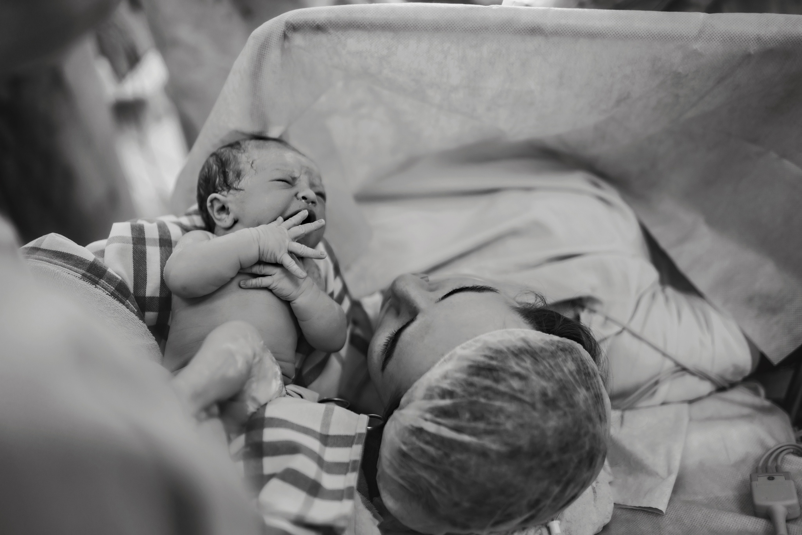 C-Section Birth Photography in Austin, TX