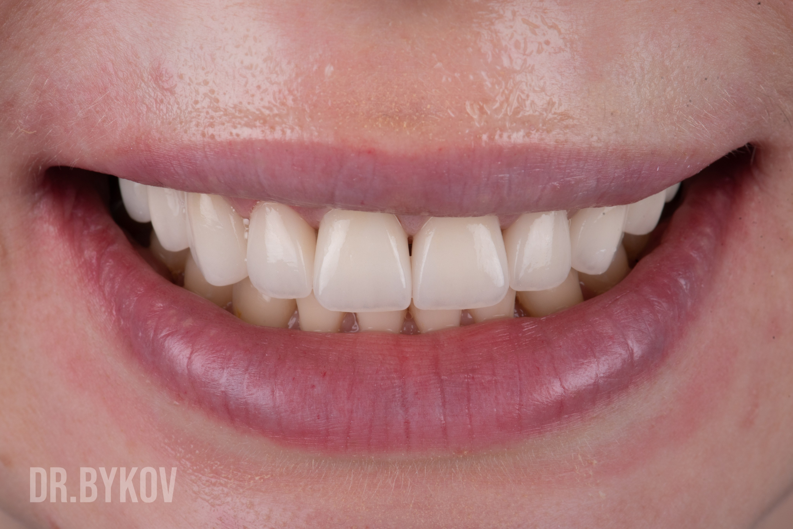 Портфолио. Врач стоматолог-ортопед Быков Алексей