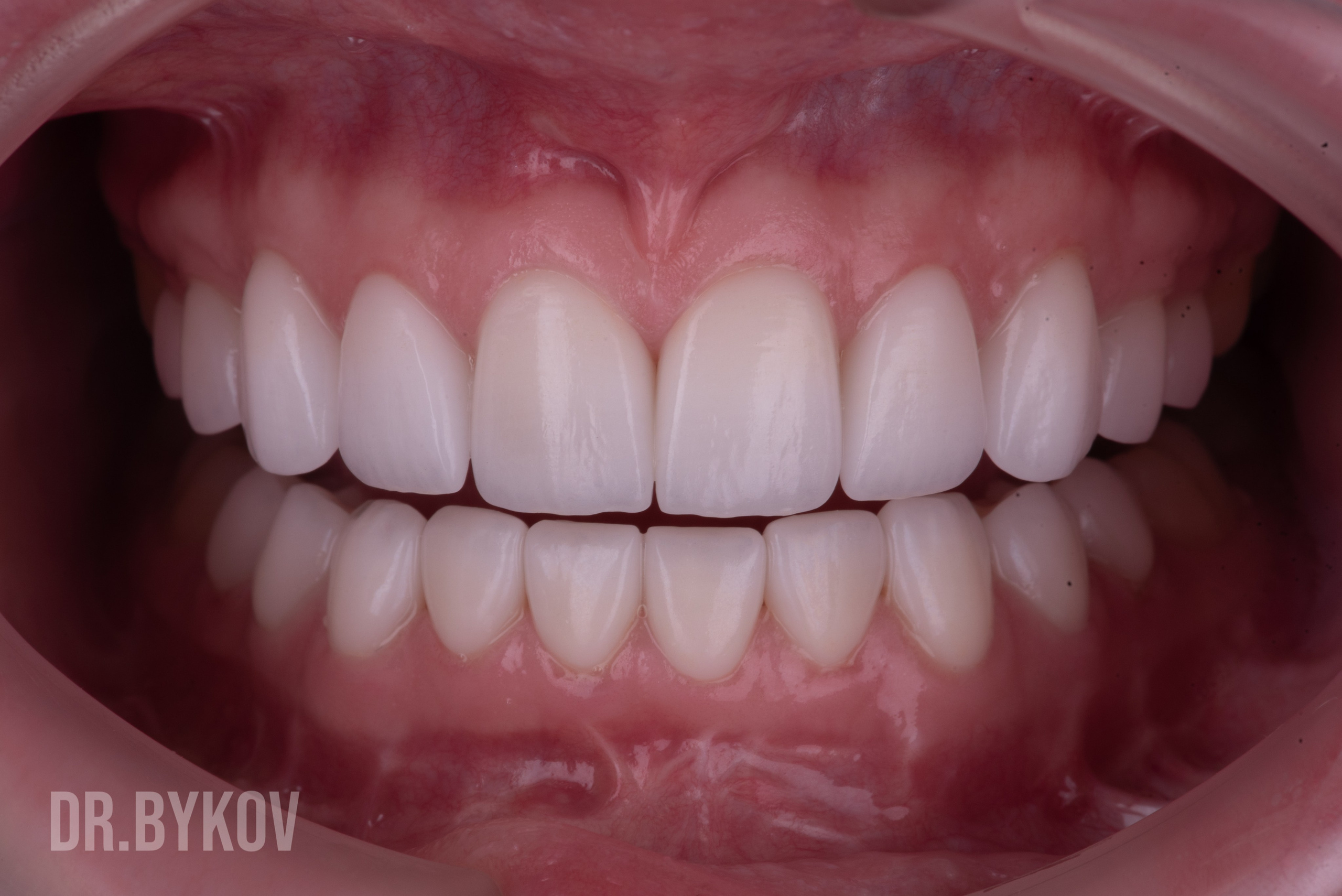 Портфолио. Врач стоматолог-ортопед Быков Алексей