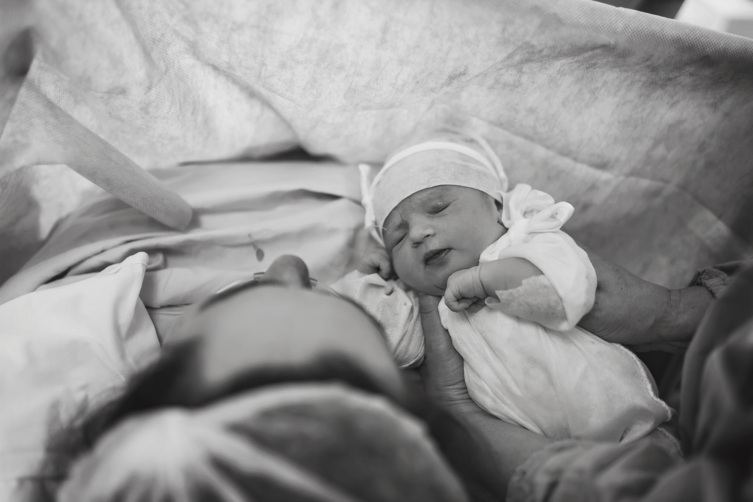 C-Section Birth Photography in Austin, TX