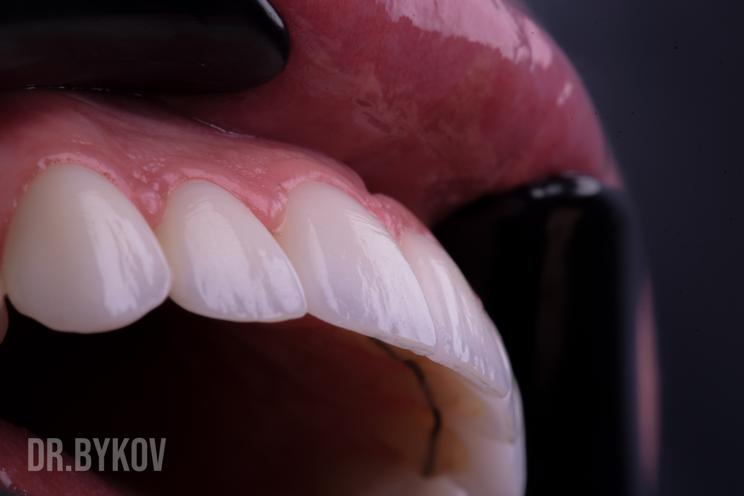 Портфолио. Врач стоматолог-ортопед Быков Алексей