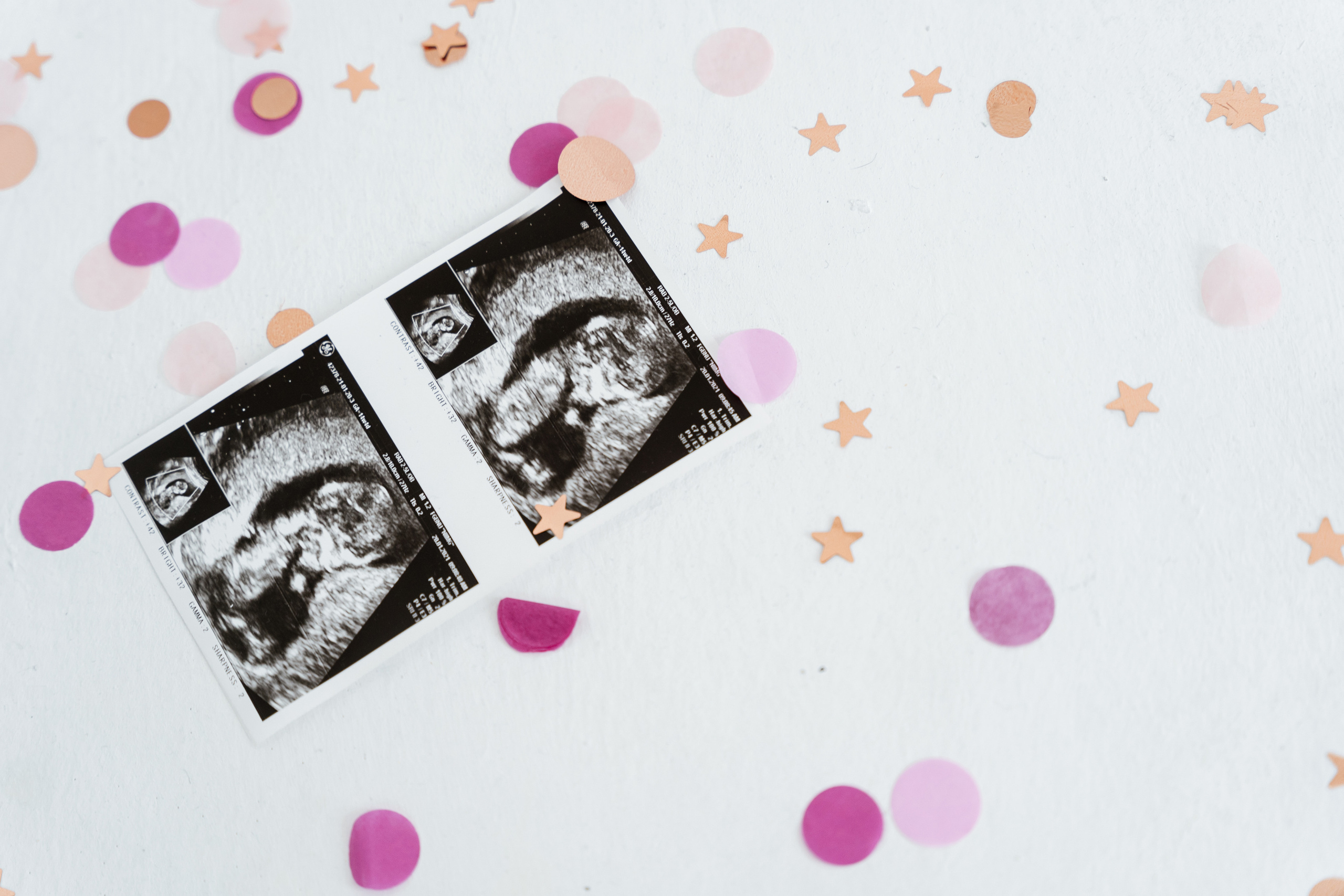 Мальчик или девочка?. Фотограф Томск, Новосибирск Влад Свириденко