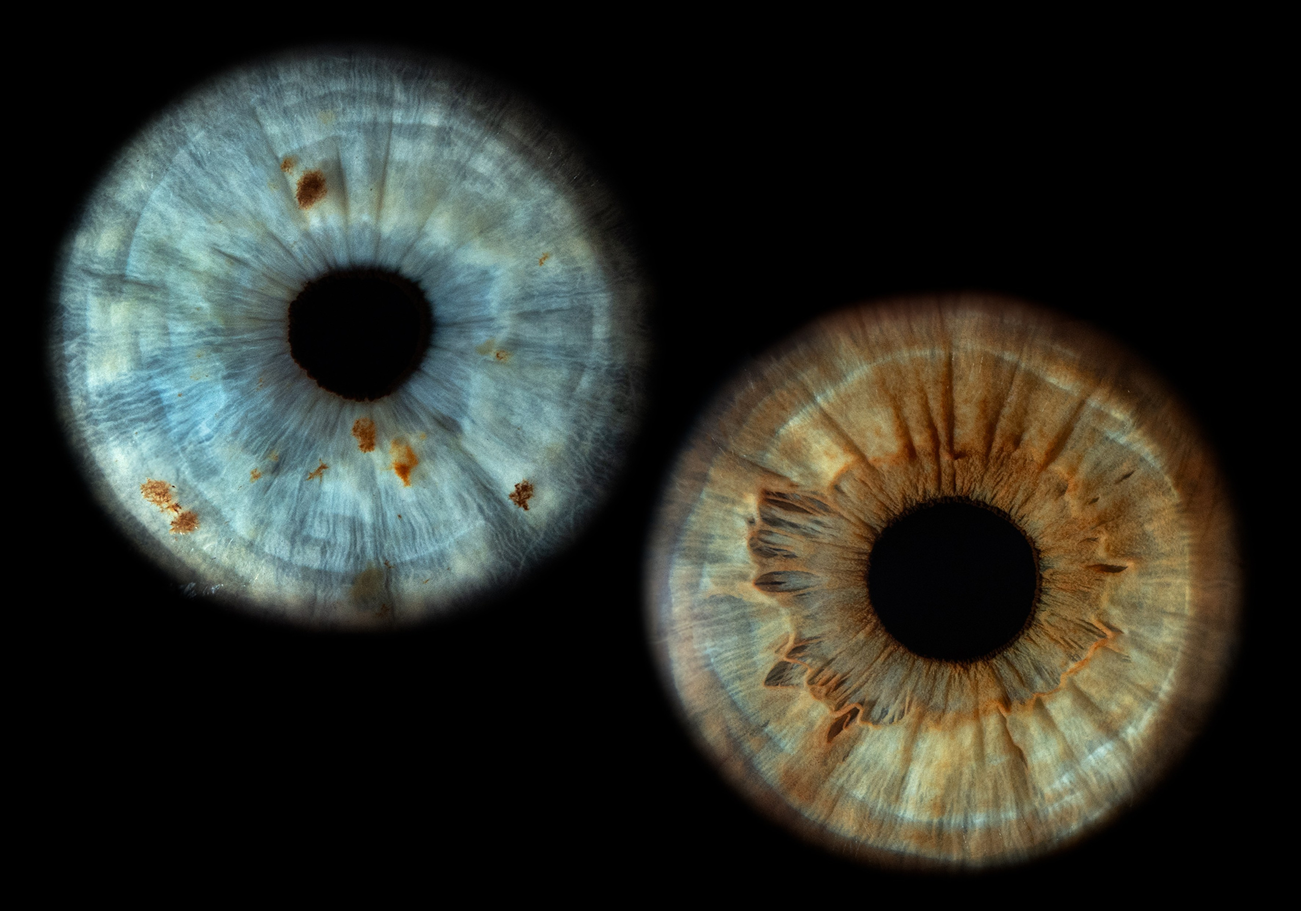 Фото радужки глаза в высоком разрешении и детализации. Крым, Севастополь. Ojo Art