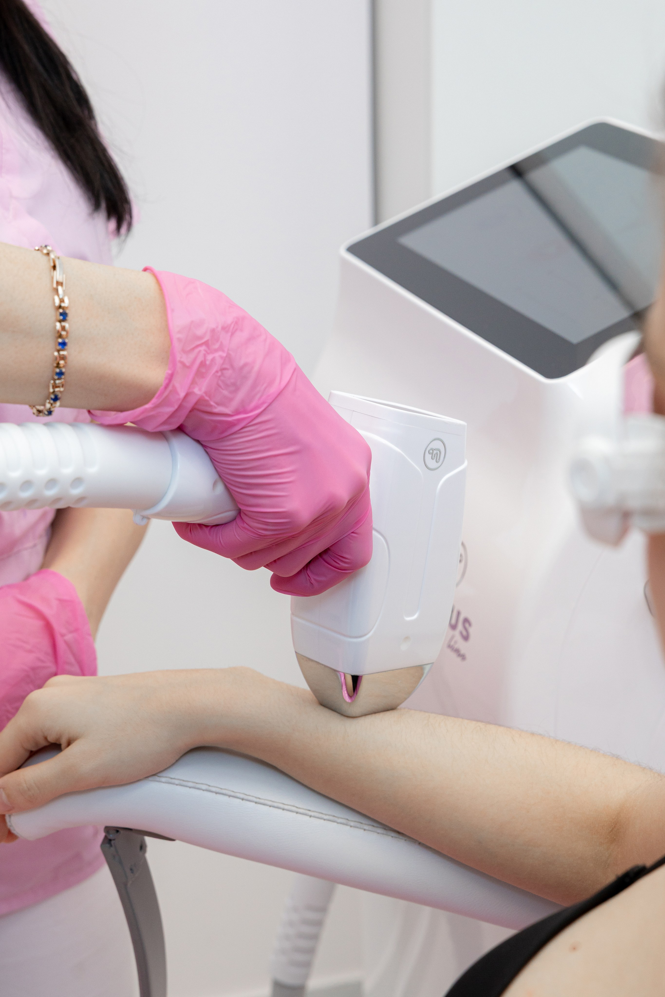 Процедура лазерной эпиляции на руке девушки