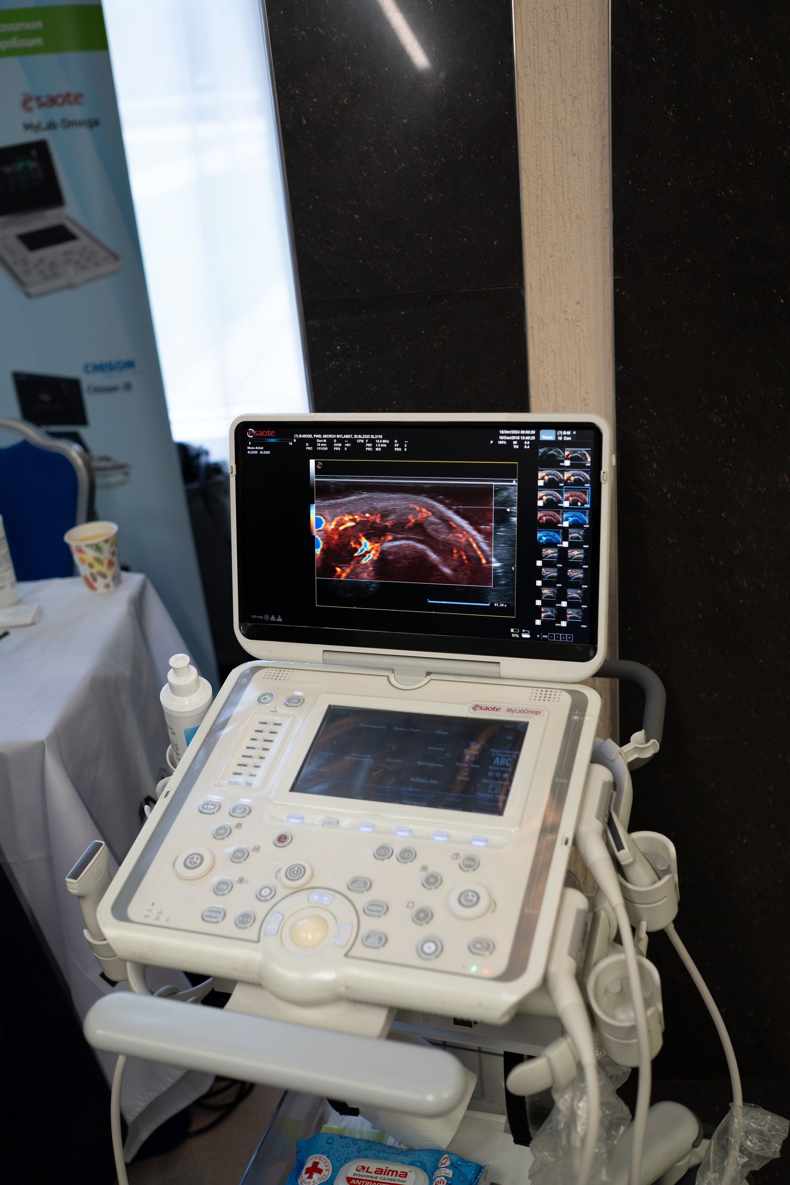 Кавказский венозный форум (репортаж). Фотограф, видеограф Пятигорск, Ставрополь, Ессентуки, Petlyakovs_photo