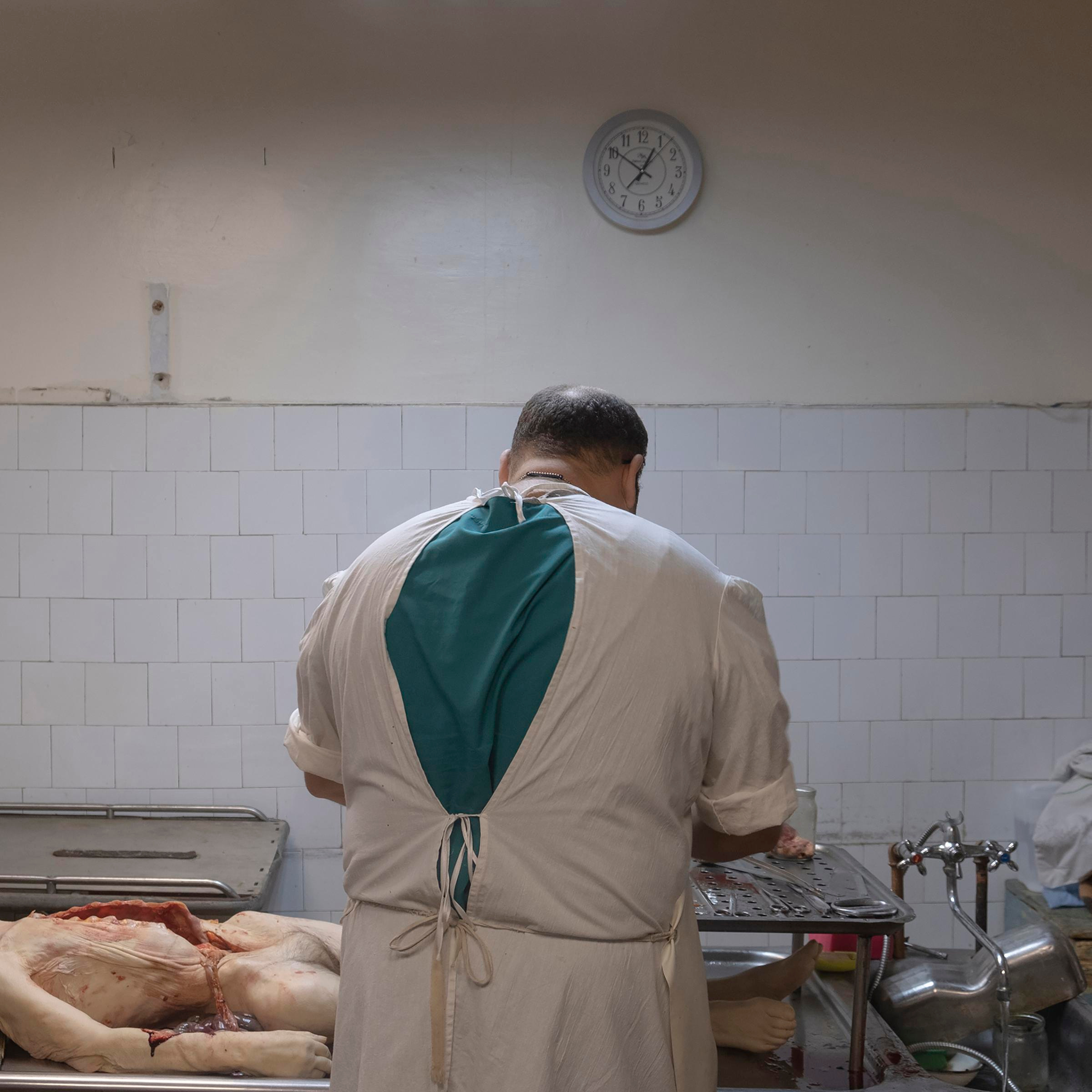 Autopsy of the human body