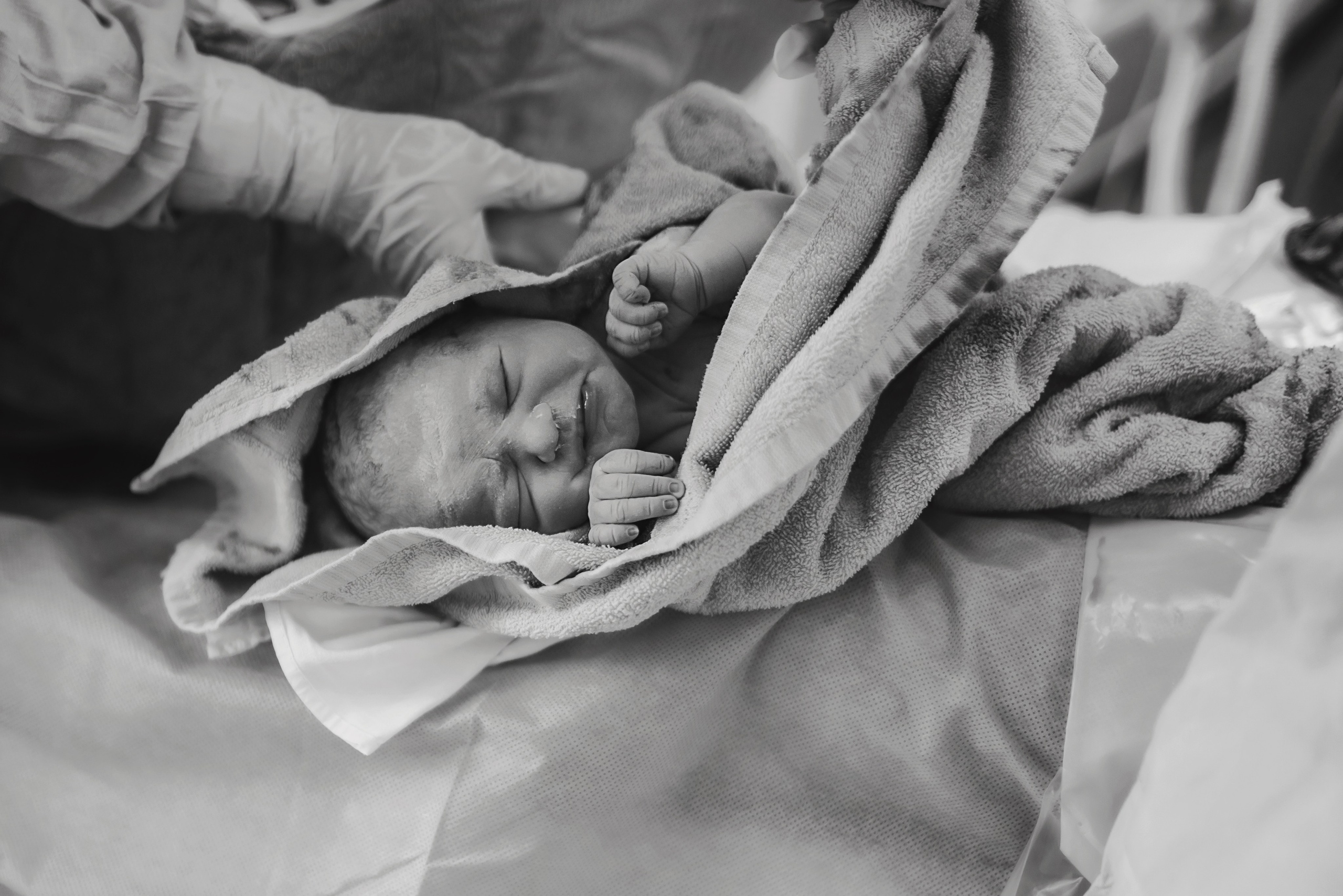 C-Section Birth Photography in Austin, TX