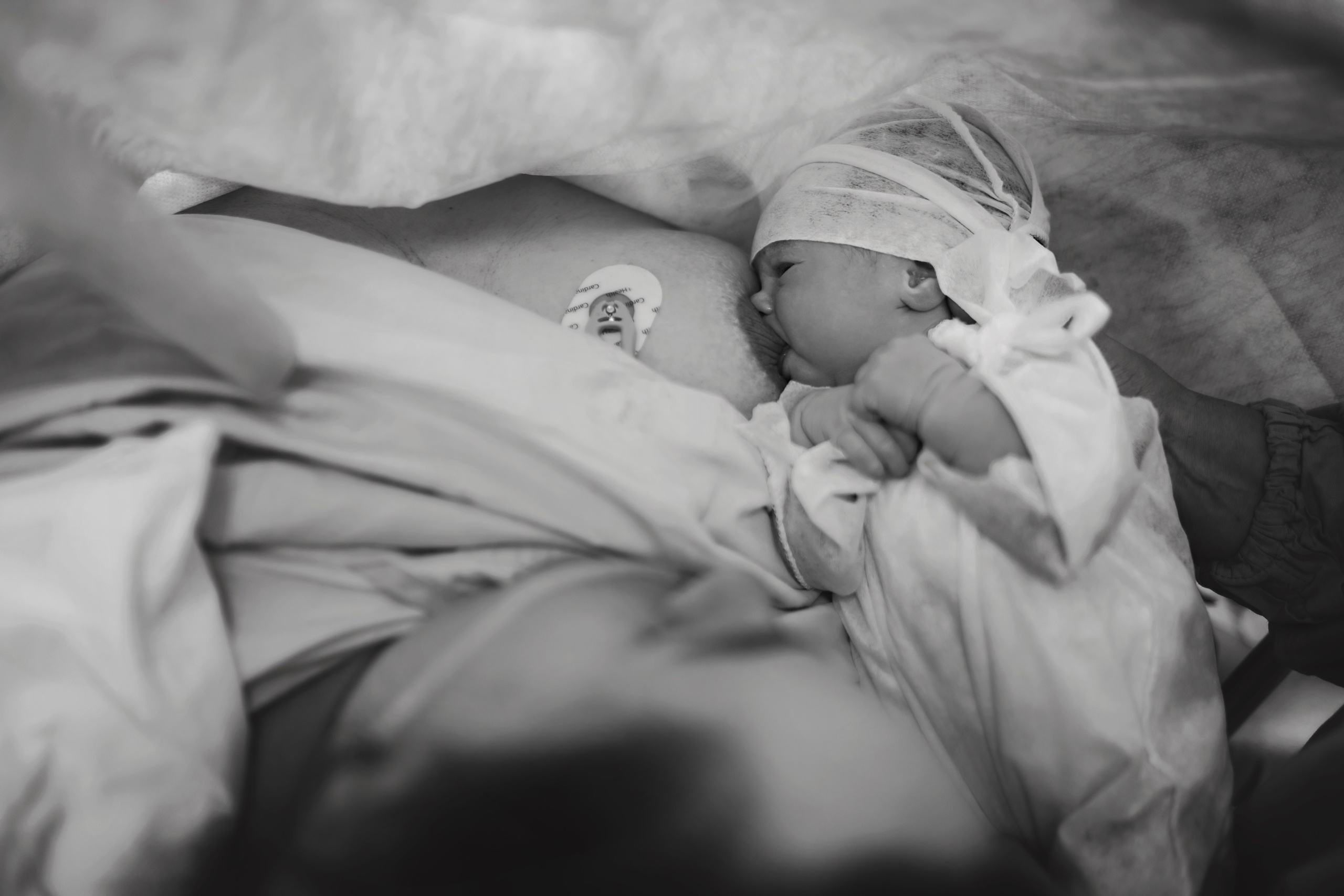 C-Section Birth Photography in Austin, TX