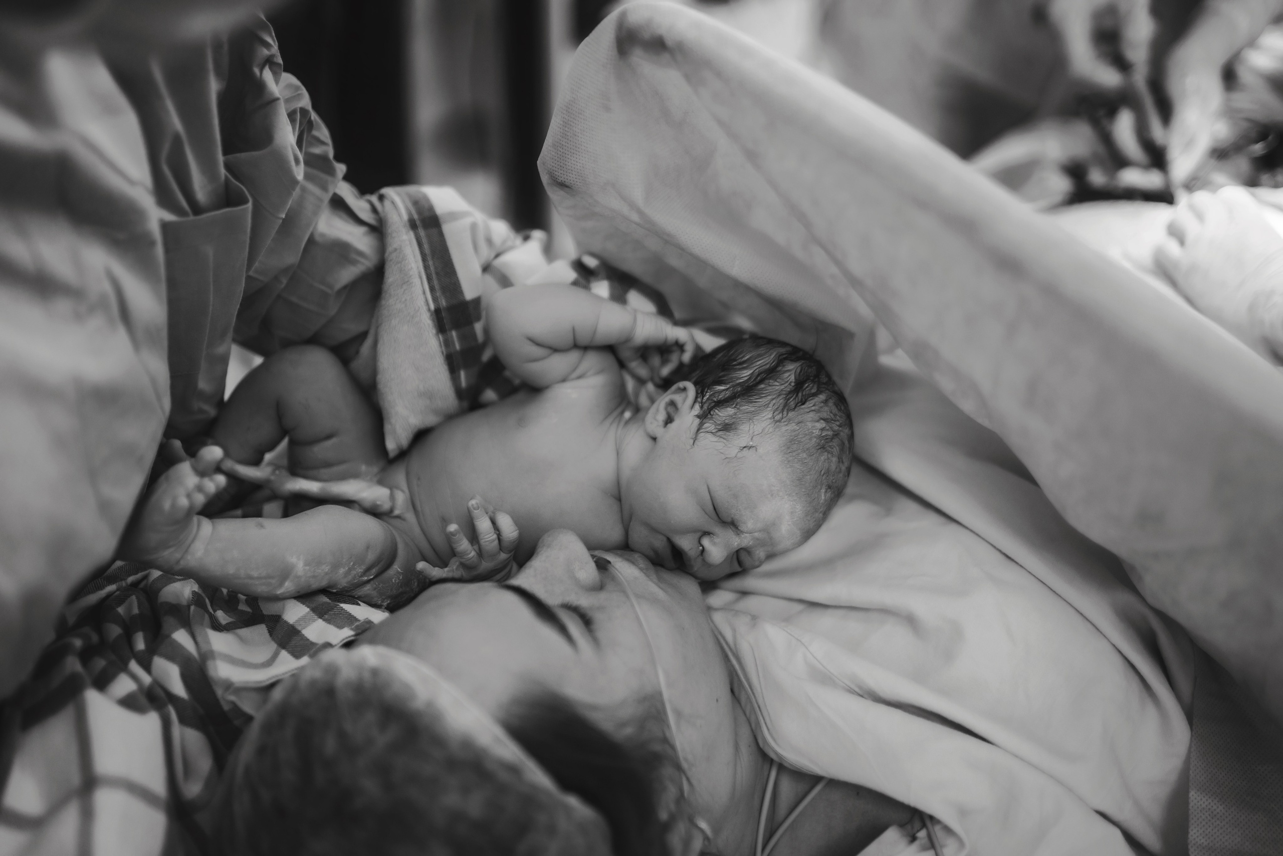 C-Section Birth Photography in Austin, TX