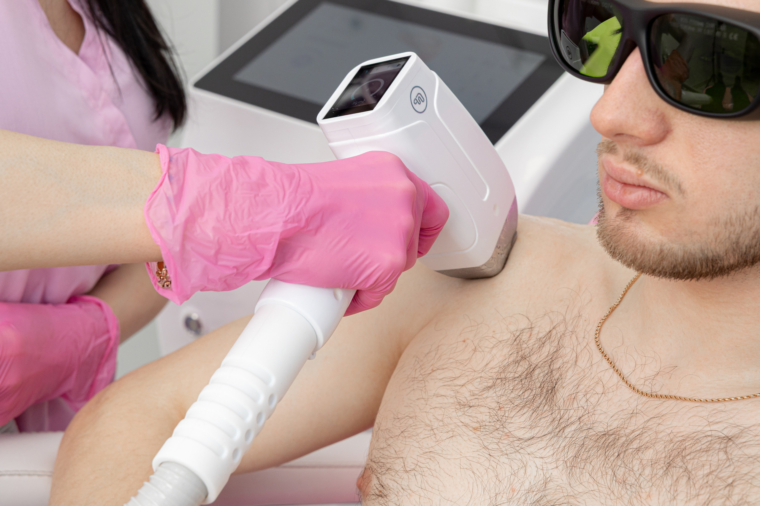 Мужчине проводят процедуру лазерной эпиляции на руке