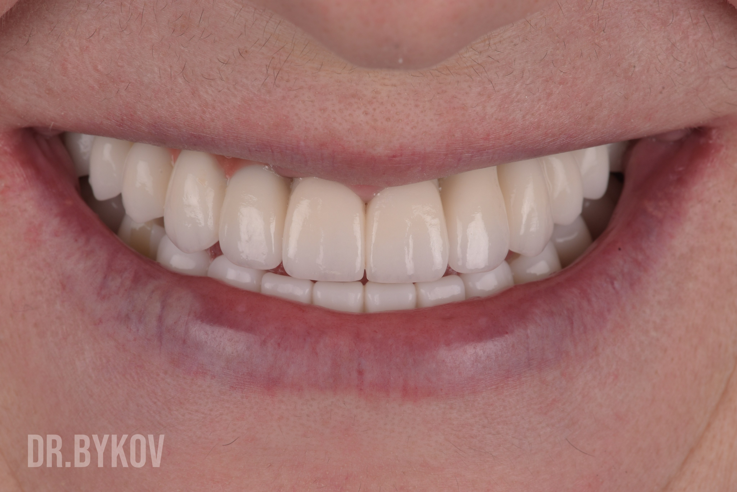 Портфолио. Врач стоматолог-ортопед Быков Алексей