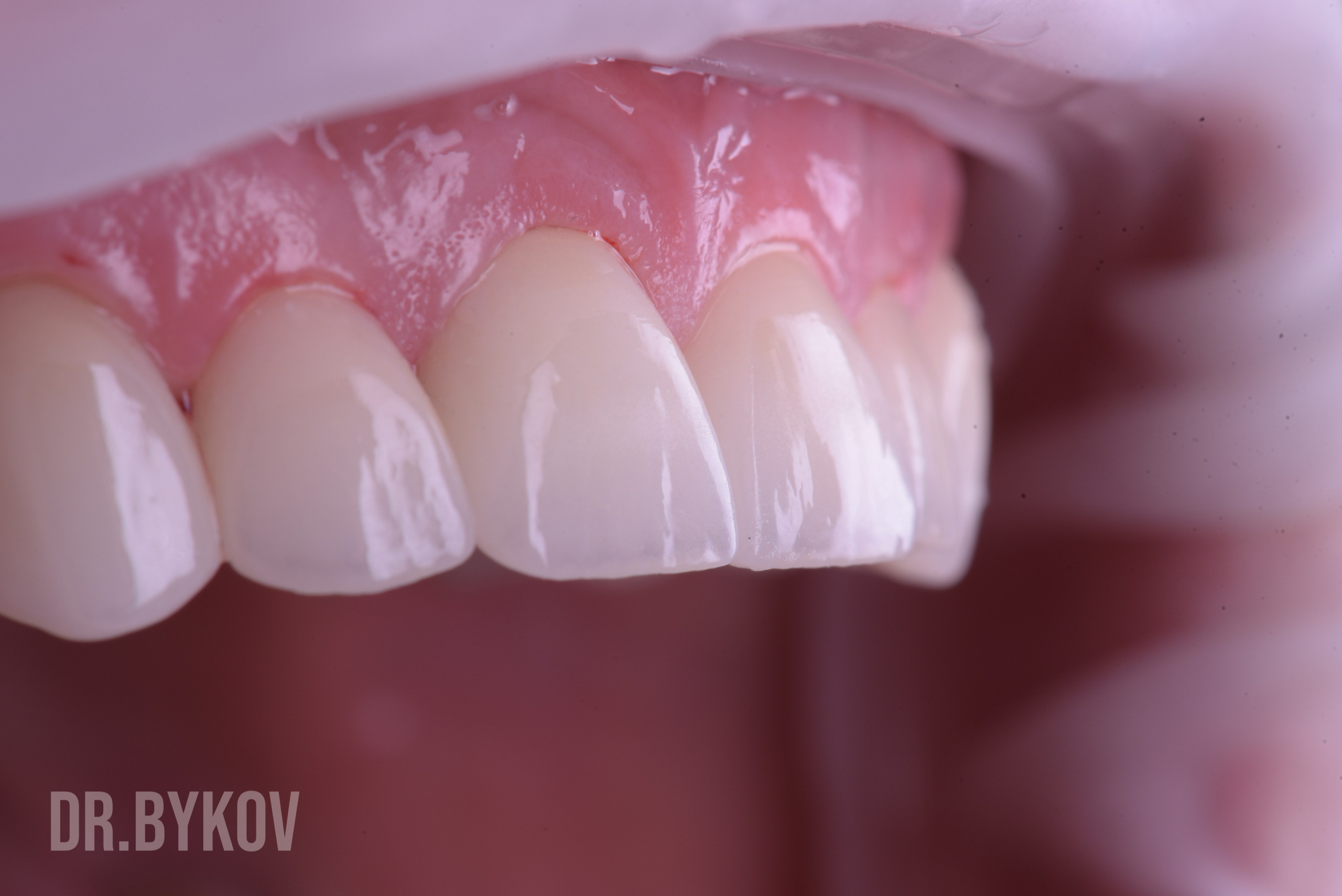 Портфолио. Врач стоматолог-ортопед Быков Алексей