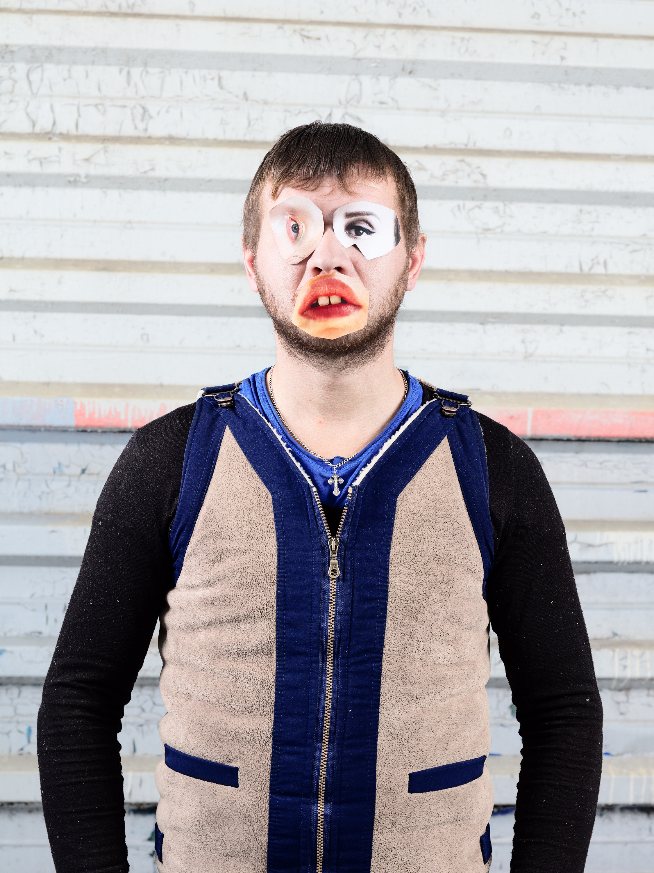 Andrey (31). He has a rare form of visual agnosia