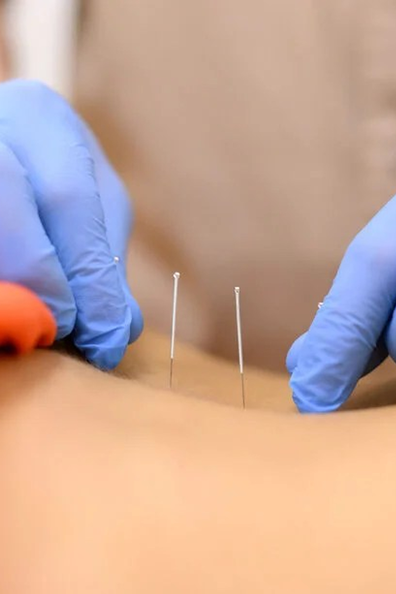 Варикоз. Облегчение симптомов. Шаг за шагом