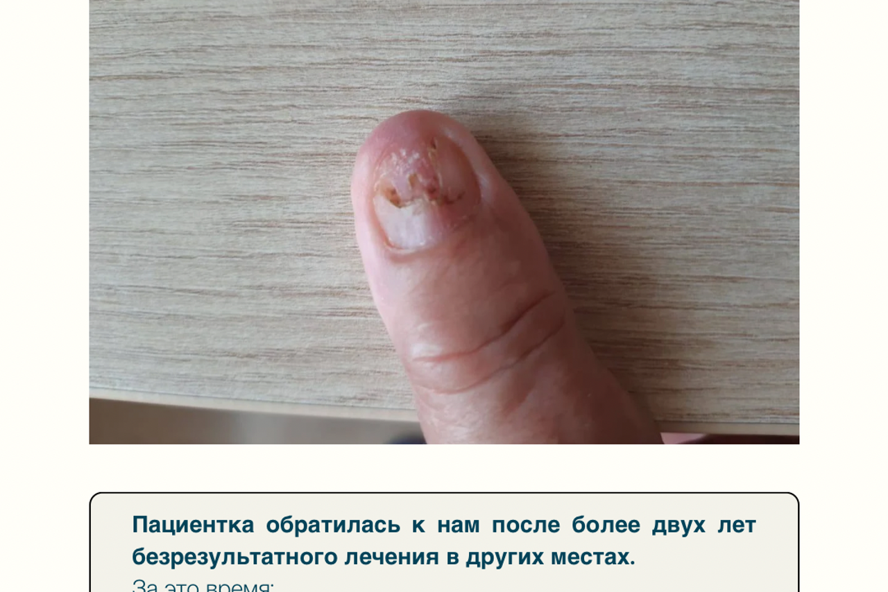 Как не надо делать. Подолог г. Хабаровск — студия подологии и педикюра Александры Дробот ФУТТАЙМ/FOOTTIME
