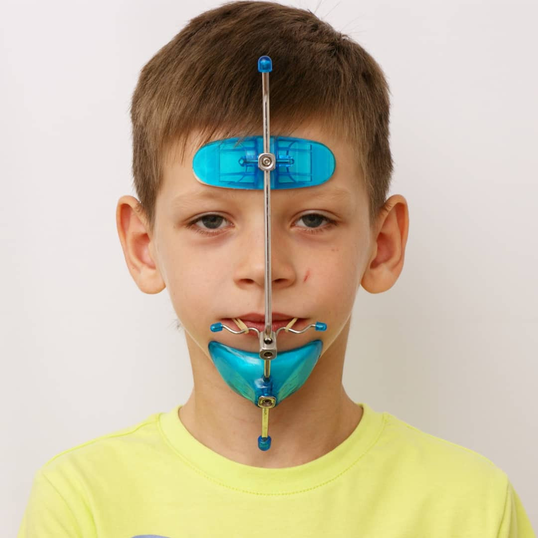 Блог врача. Стоматология «Ортодонт-Эстетик». Установка брекетов в Оренбурге, взрос