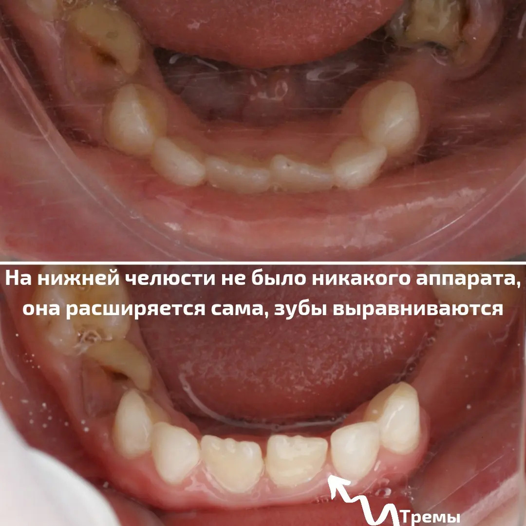 Блог врача. Стоматология «Ортодонт-Эстетик». Установка брекетов в Оренбурге, взрос