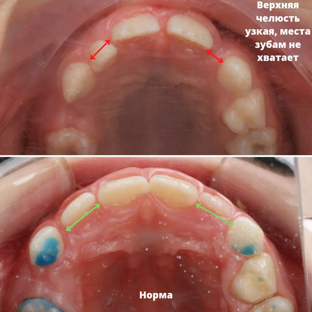 Блог врача. Стоматология «Ортодонт-Эстетик». Установка брекетов в Оренбурге, взрос