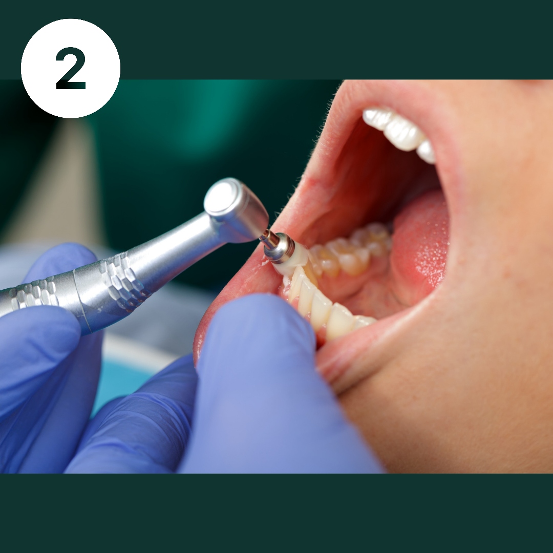 Блог врача. Стоматология «Ортодонт-Эстетик». Установка брекетов в Оренбурге, взрос