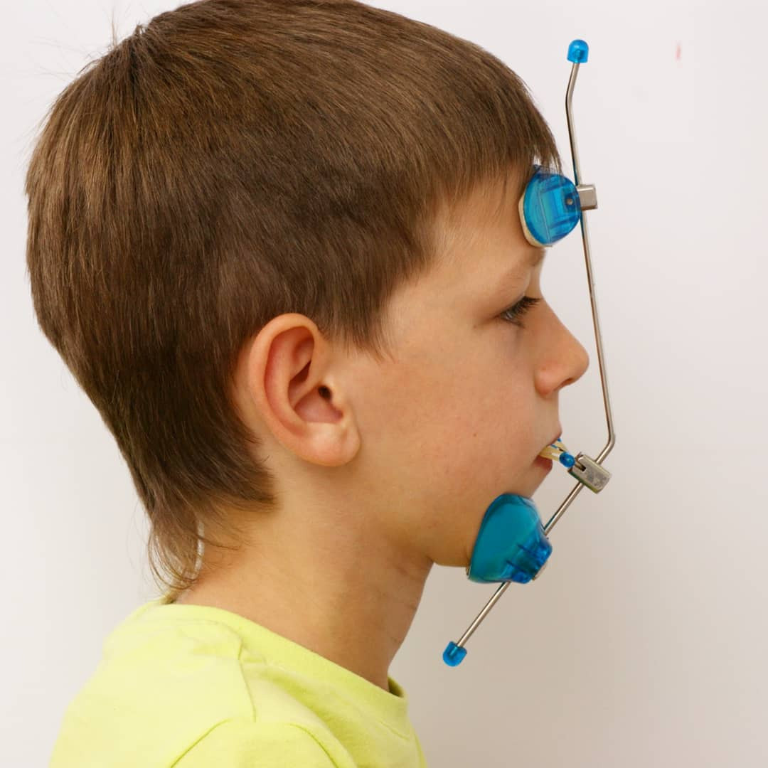 Блог врача. Стоматология «Ортодонт-Эстетик». Установка брекетов в Оренбурге, взрос